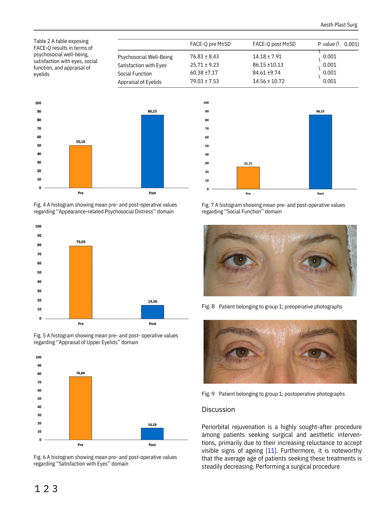 Digest of a scientific article with tables and photographs showing pre- and post-operative data related to psychosocial and aesthetic criteria, alongside photographs of a woman's face before and after surgery.