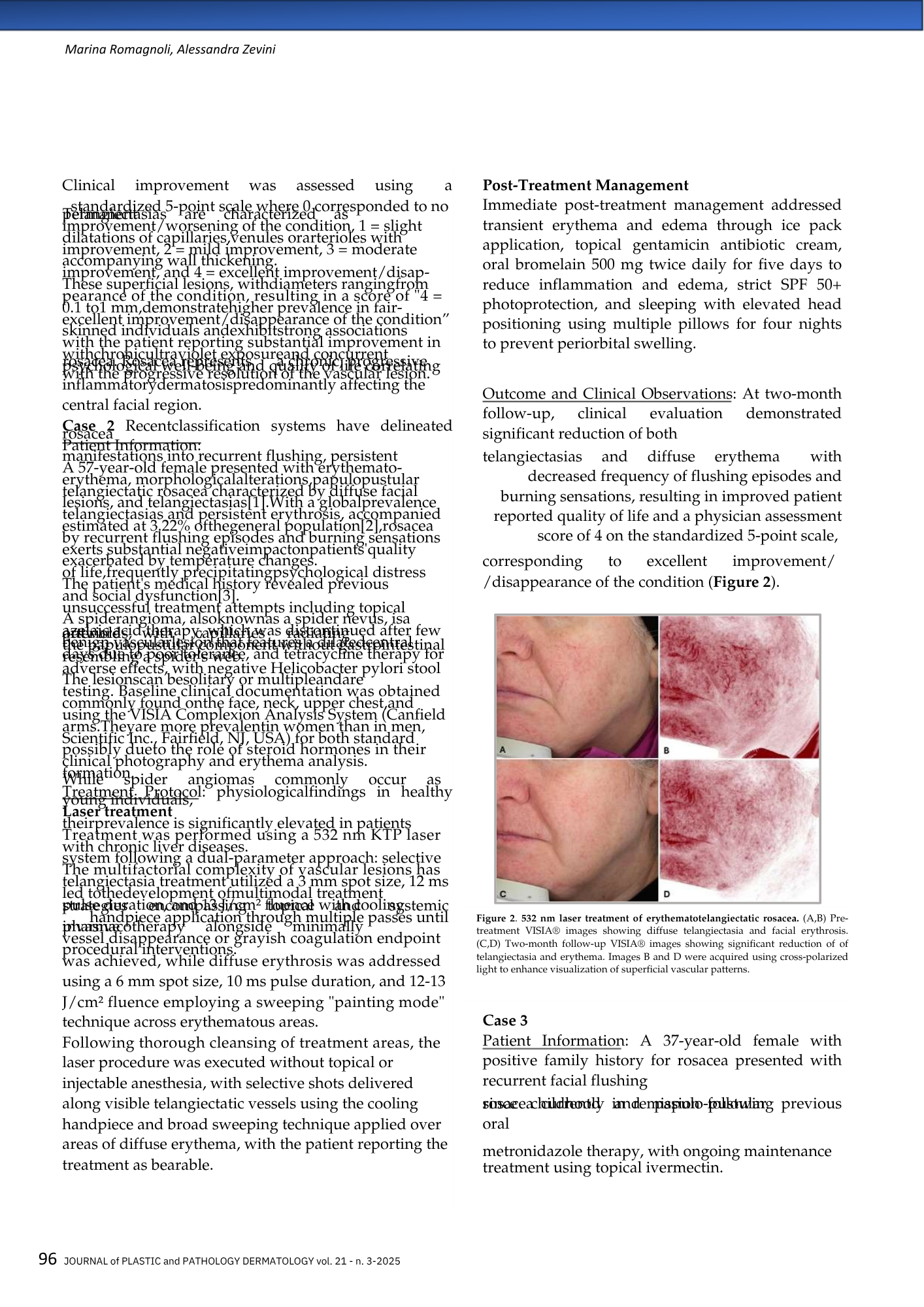 Pagina di rivista medica con testo e immagini cliniche. Include una sezione su 'Post-Treatment Management' e immagini di trattamento laser di rosacea con conclusioni su miglioramenti evidenti.