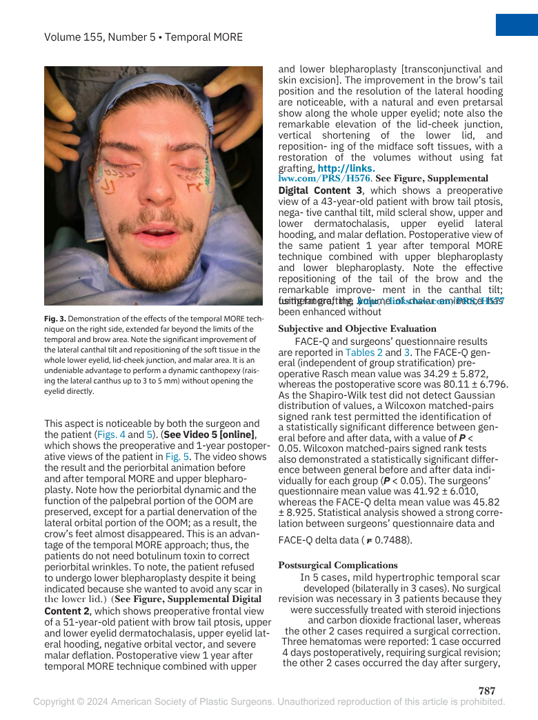 Un uomo riceve un trattamento estetico sulla fronte, con gli occhi chiusi, mentre due mani indossano guanti si trovano ai lati del suo volto.