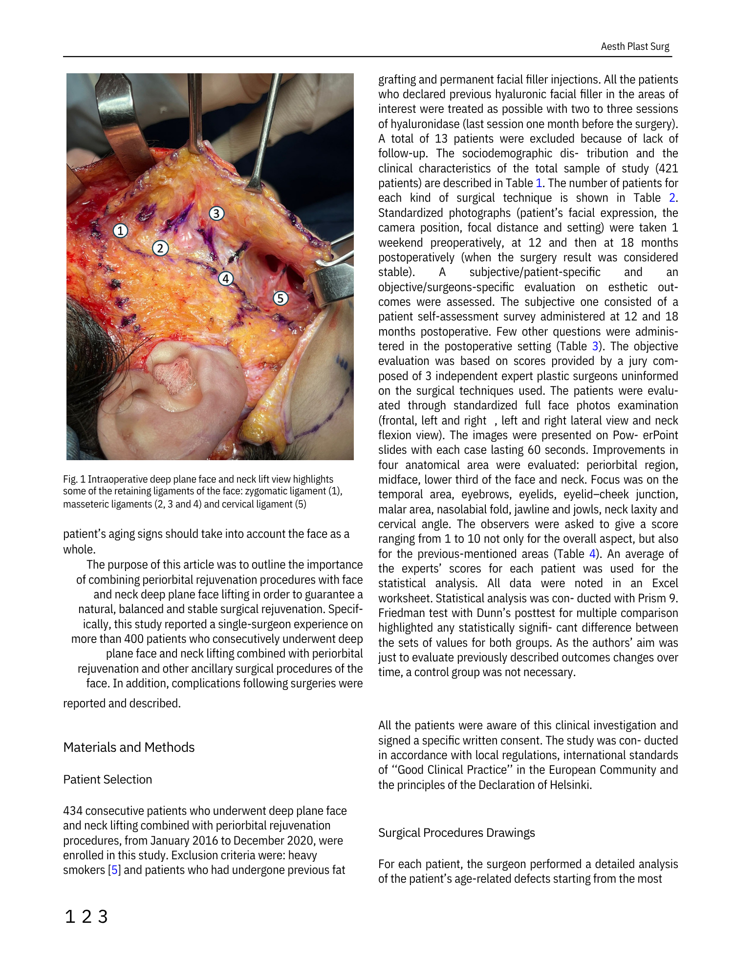 Foto chirurgica di un intervento di lifting facciale e viso con vari strumenti chirurgici, mostrazionando la zona della faccia e del collo con alcuni legamenti retinici evidenziati.