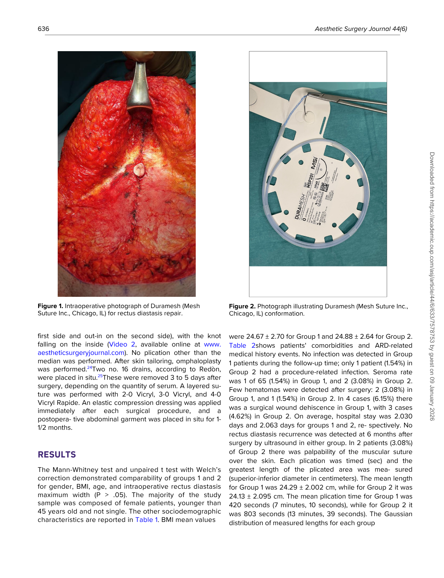 Immagine a sinistra mostra un'organo chirurgico, probabilmente un rene, durante un intervento di riparazione di una diastasi rettale con cicatrici visibili. Immagine a destra illustra un dispositivi medico utilizzato per la sutura, posizionato su un 
