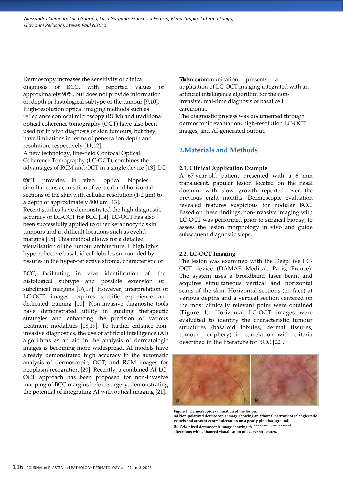 Pagina di articolo scientifico con testo e due immagini di esame cutaneo a basso rischio, una descrizione e un esempio di immagini dermoscopiche