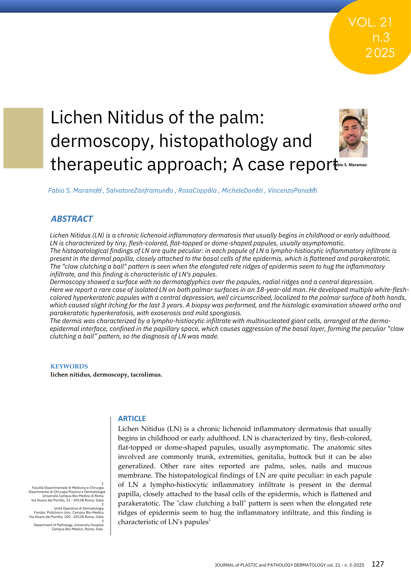 Pagina di una rivista scientifica con titolo, autori e abstract di un articolo medico sulla lichenoid dermatitis del palmo, evidenziando un'immagine del viso di un autore in alto a destra.