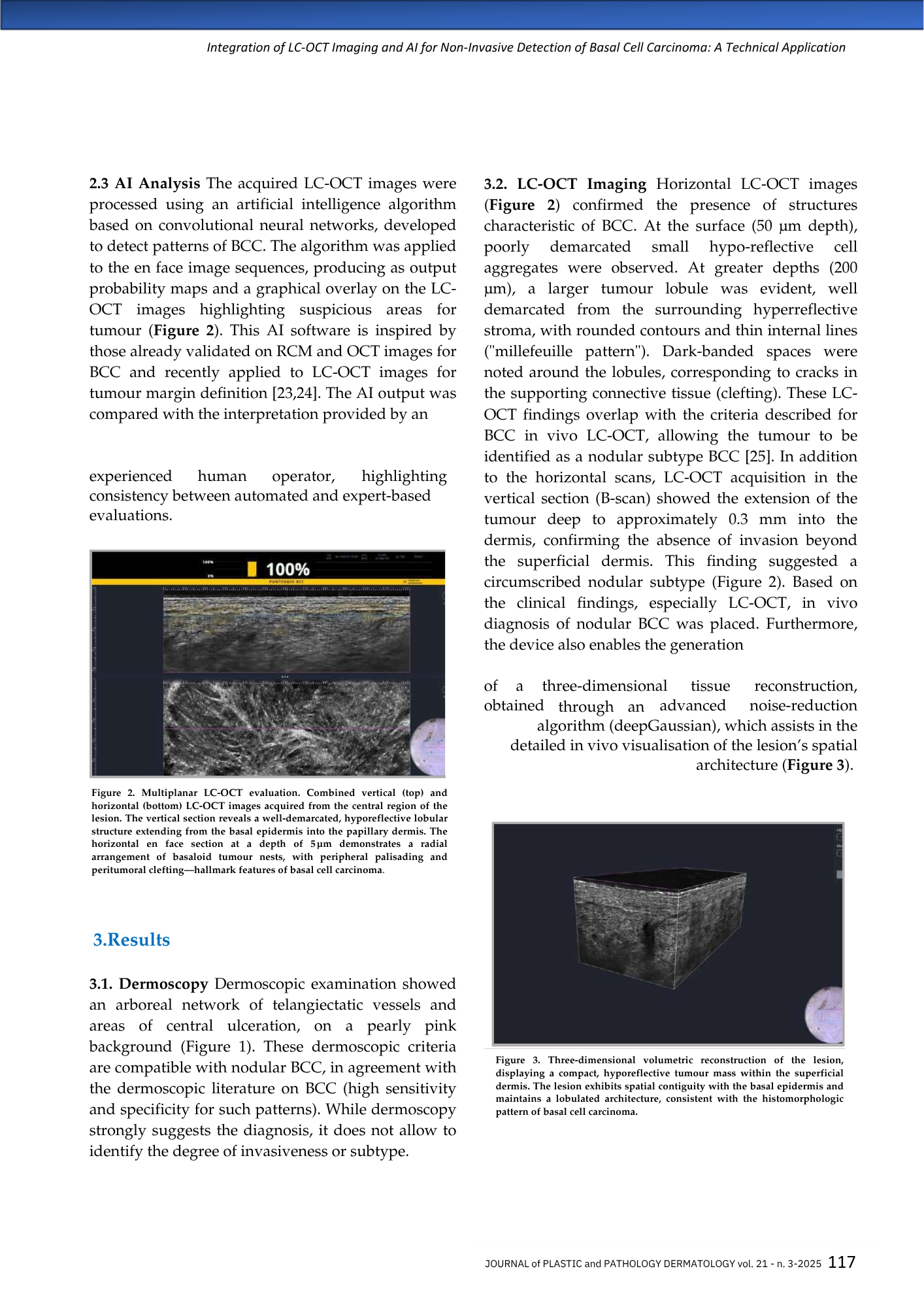 Pagina di un articolo scientifico con testi, due immagini di valutazione LC-OCT e una ricostruzione volumetrica tridimensionale di una lesione cutanea.