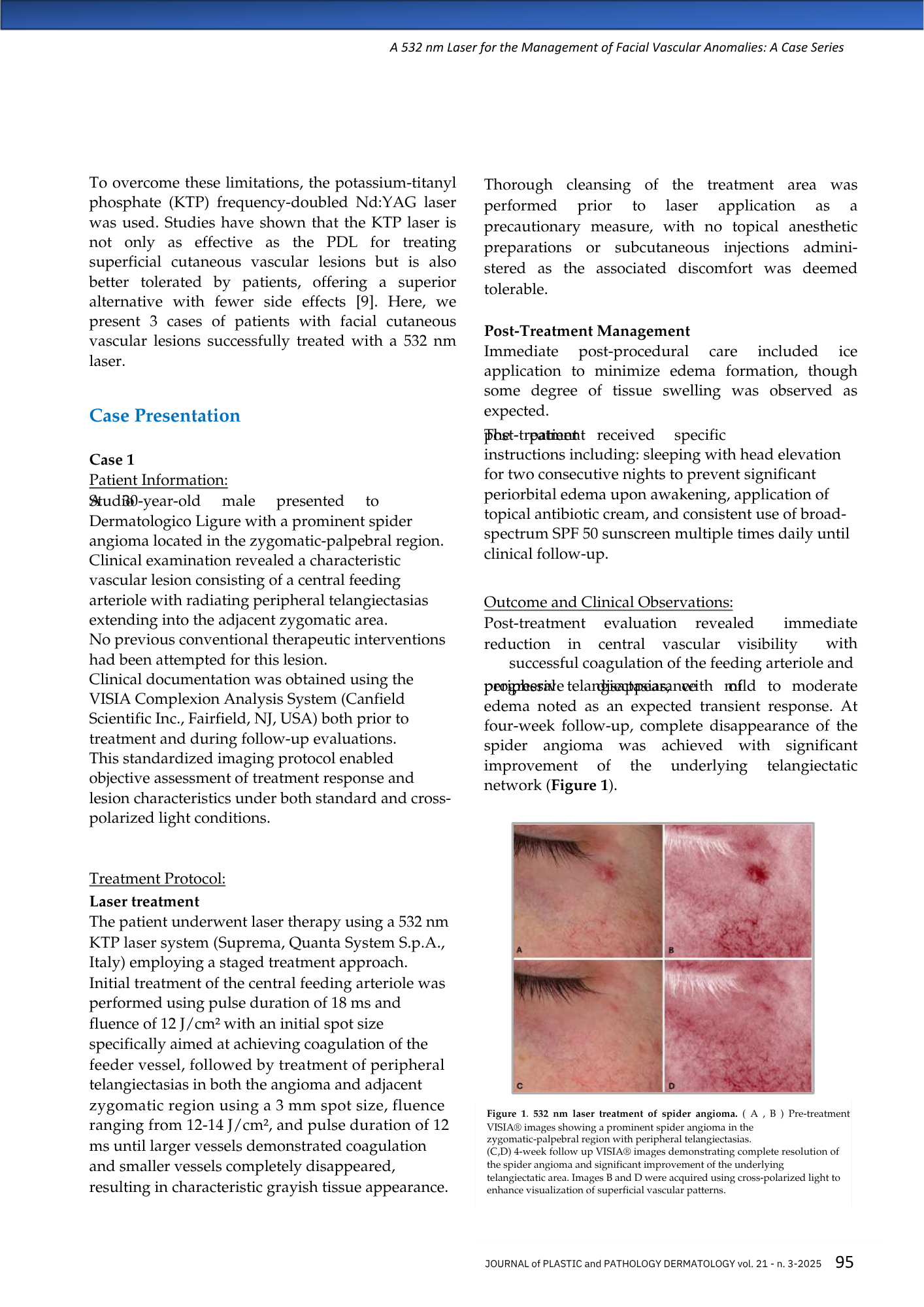 Immagini che mostrano trattamenti laser per un angioma del ragno, con immagini pre e post trattamento di aree della pelle.