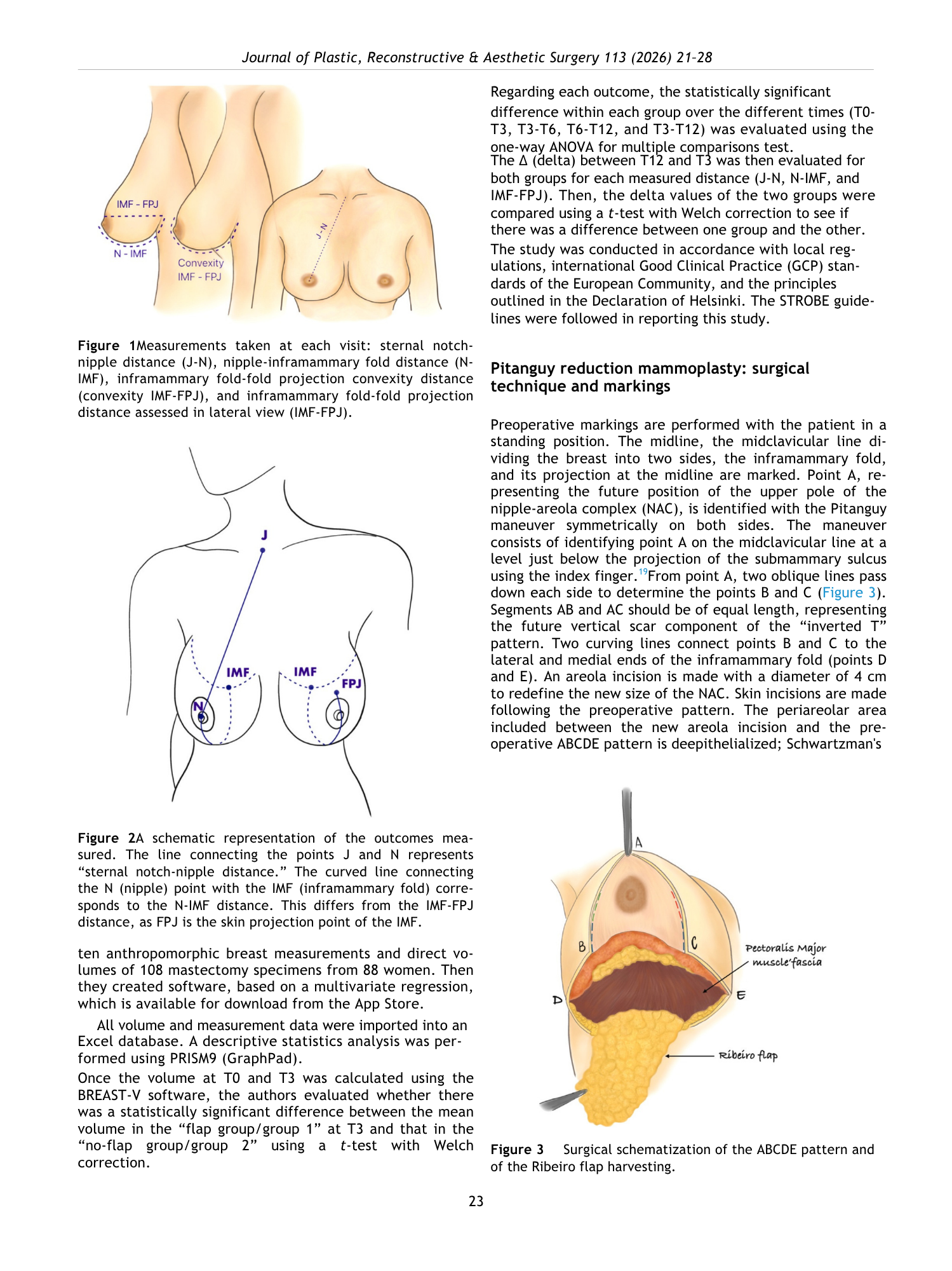 Immagine di una pagina di un articolo scientifico con diagrammi e illustrazioni sulla chirurgia plastica del seno, inclusa una rappresentazione schematica dell'intervento e delle misurazioni preoperatorie.
