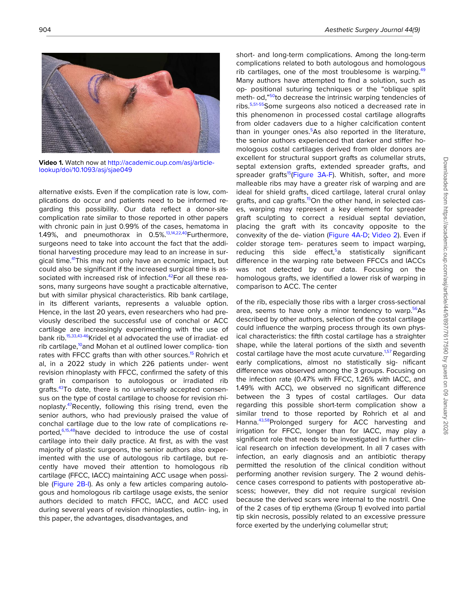 Immagine di un volto di una donna durante un intervento di chirurgia estetica, con un cappellino e coperta chirurgica.