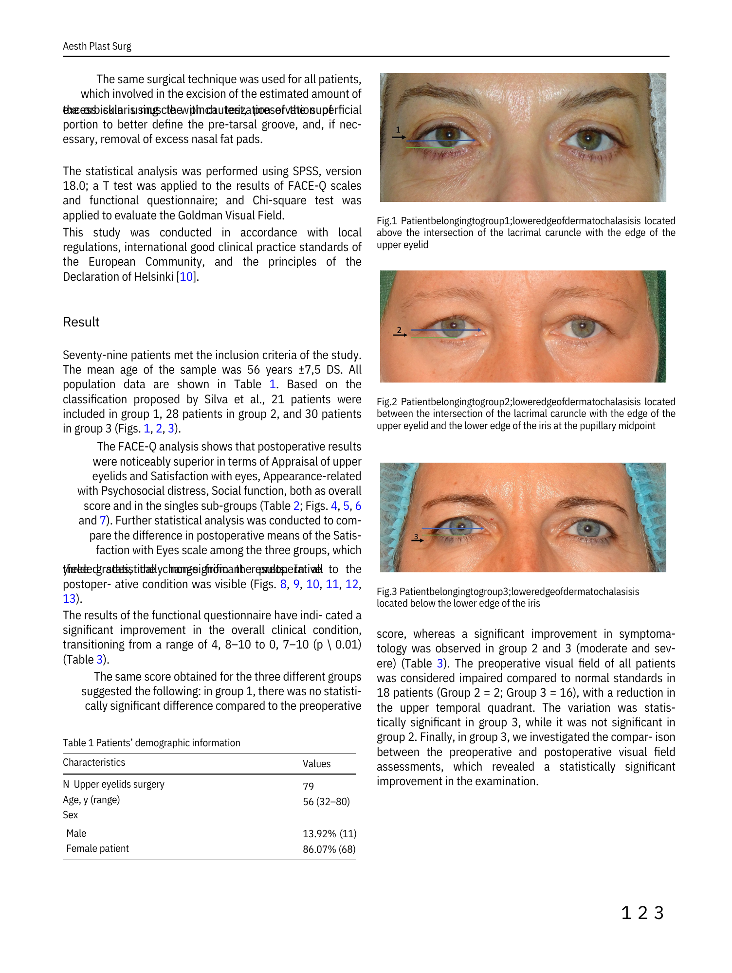 Immagine di una pagina di testo con tre fotografie di occhi umani, ciascuna accompagnata da descrizioni e numerazioni. La prima foto mostra un occhio con una linea che indica la zona superiore della palpebra, la seconda un occhio con linee che indica