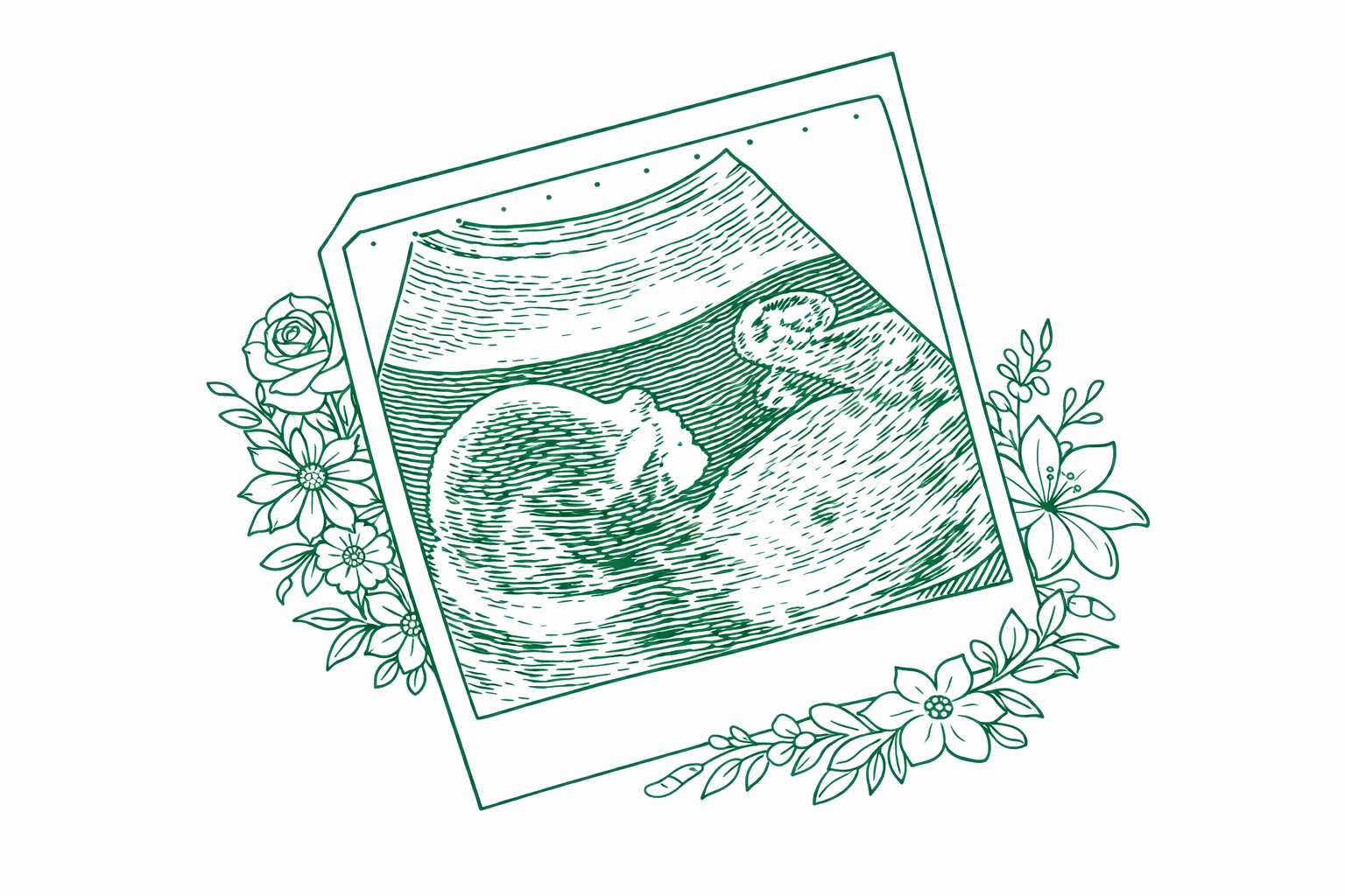 Pregnancy ultrasound