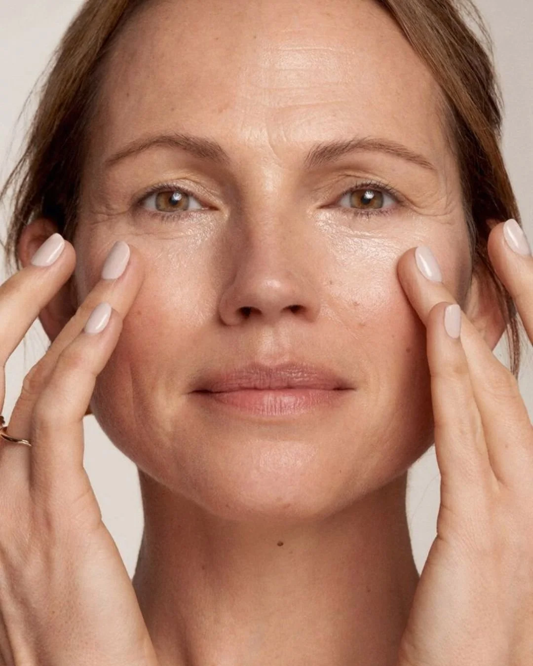tratamiento de ojeras