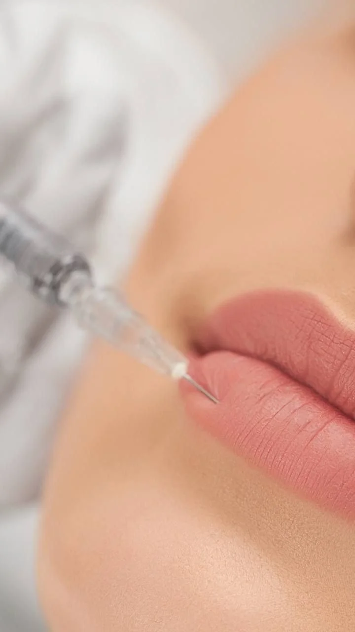 aumento de labios