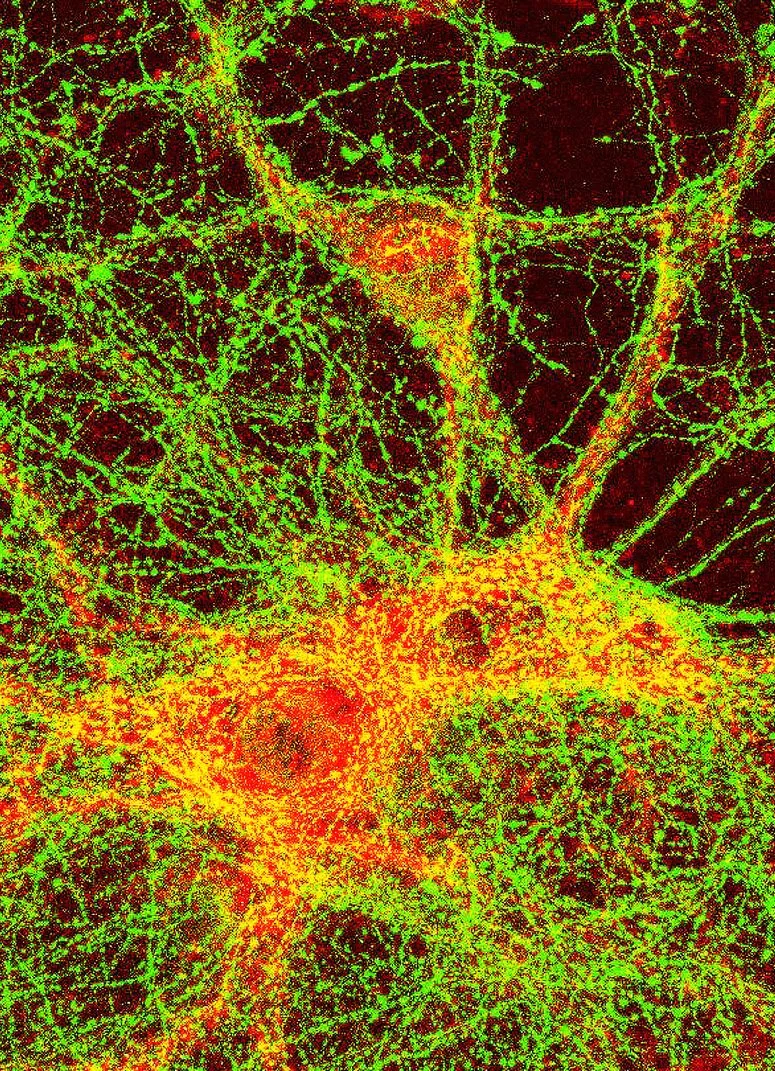 Neuron, screenprint (collaboration with Dr Judith Pratt, neuroscientist) 40 x 50 cm