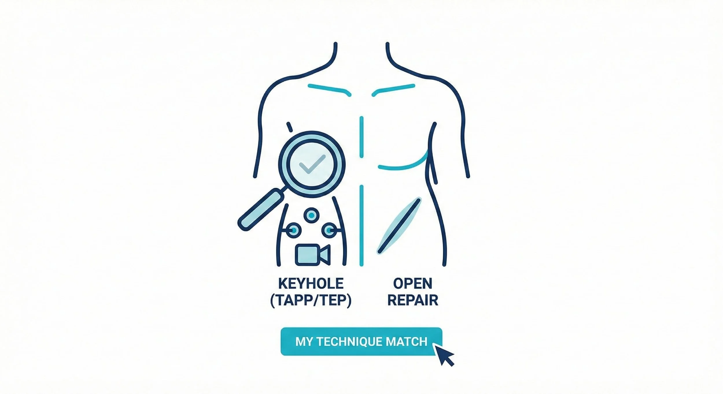 Diagram comparing two hernia repair techniques: keyhole (TAPP/TEP) on the left with a magnifying glass and check mark, and open repair on the right with a diagram of an open incision. 