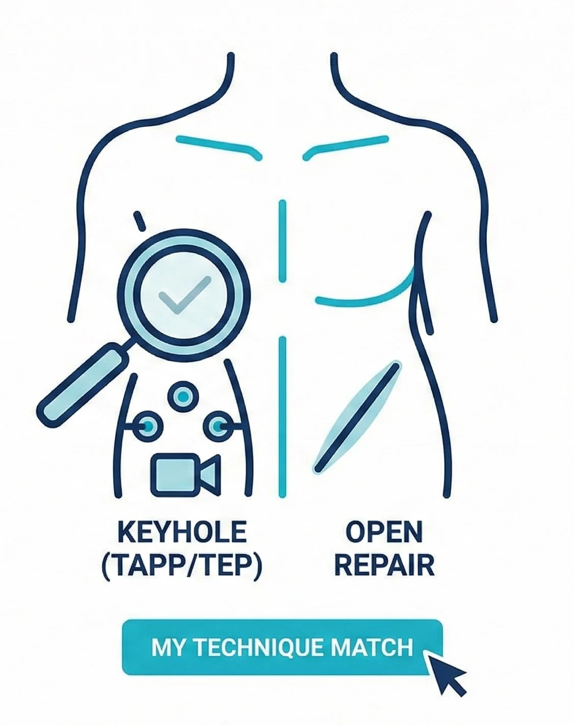 hernia surgery Southampton