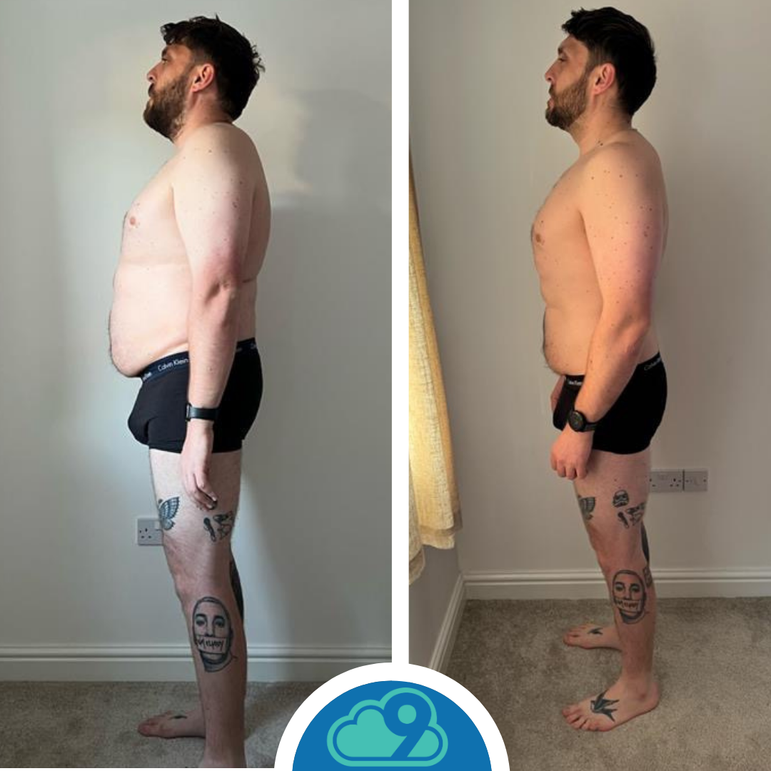 Side-by-side comparison of a shirtless man before and after weight loss, standing in profile against plain white and light-colored walls, wearing black shorts and a smartwatch, with various tattoos on his legs.