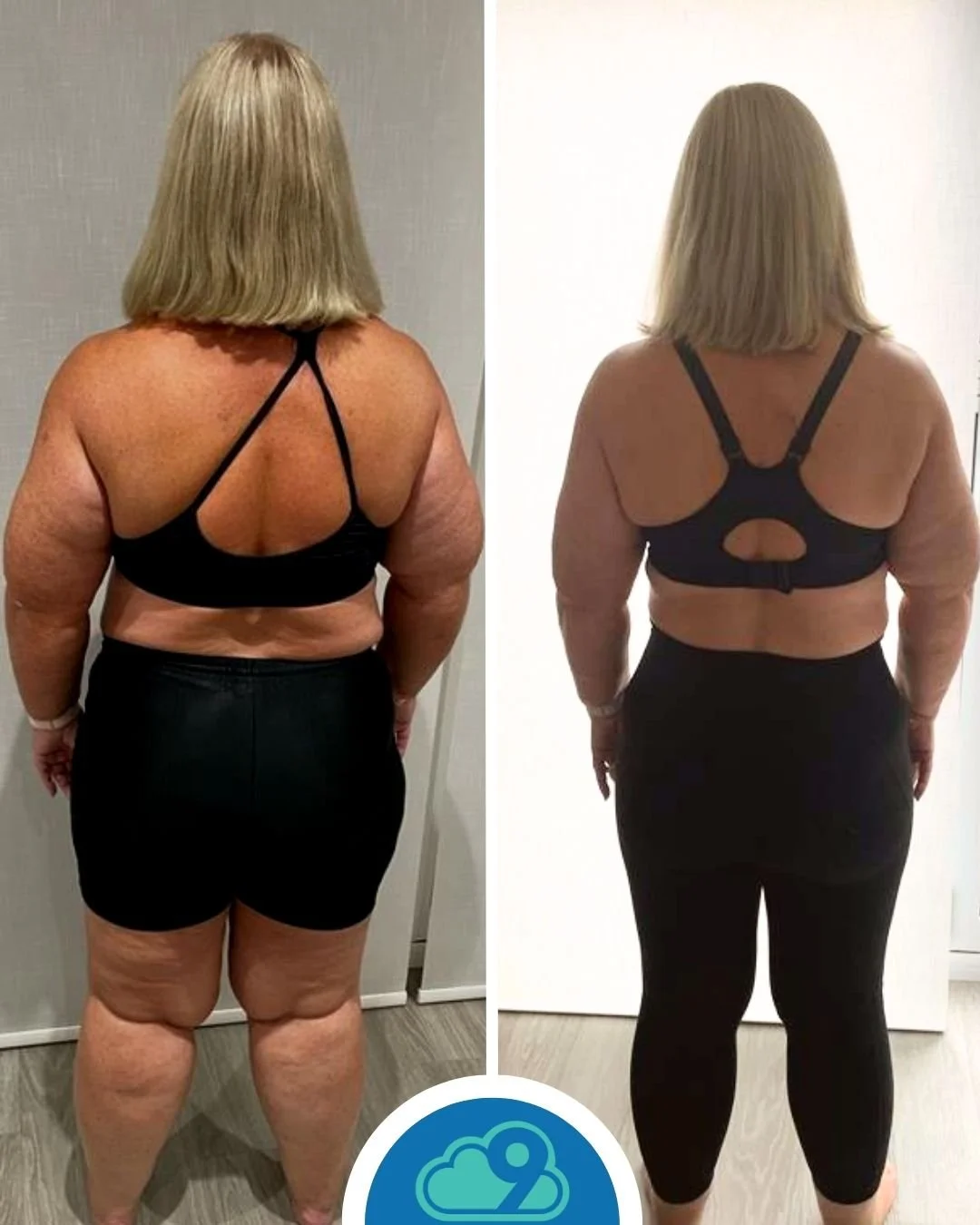 Side-by-side comparison of a woman before and after weight loss journey. In both images, she is facing away, wearing a black sports bra and black leggings, with shoulder-length blonde hair. The left image shows her with more body weight and skin sagging, while the right image shows her with a leaner physique and tighter skin.