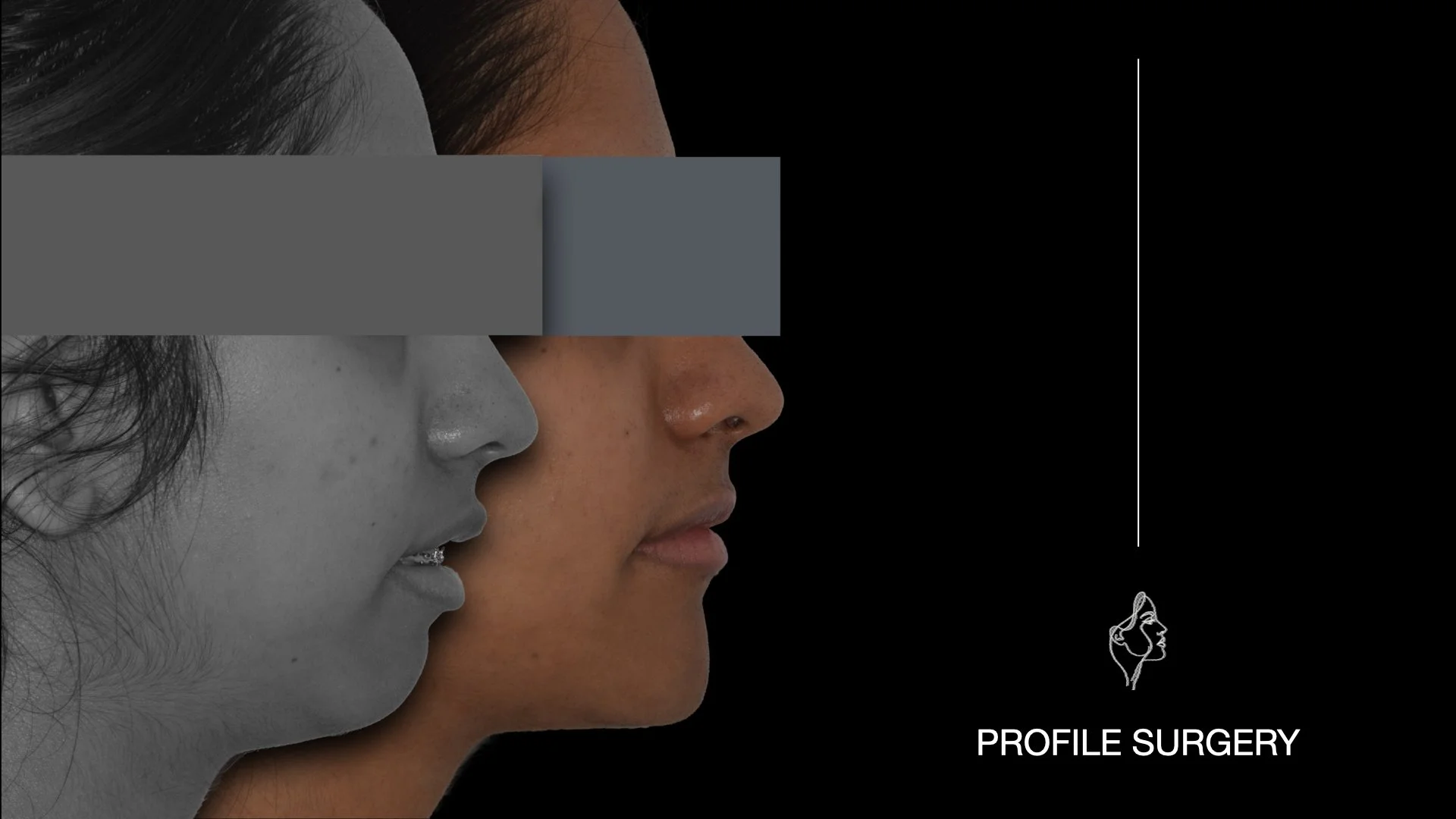 Immagine che mostra il profilo di due donne, una in bianco e nero e l'altra a colori, con un logo di un profilo di donna e la scritta 'Profile Surgery'.