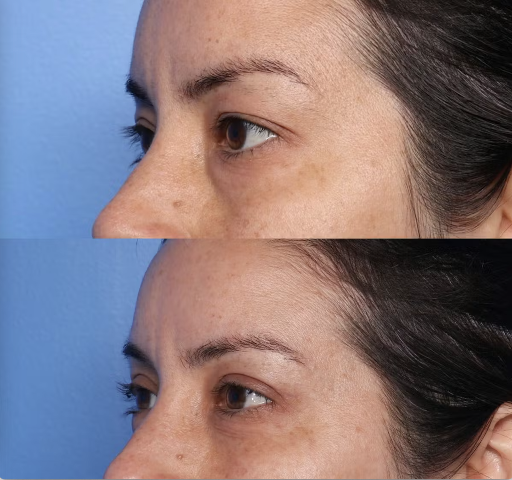 Close-up of a woman's face focusing on her eye, eyebrow, and cheek, with a blue background and natural lighting.