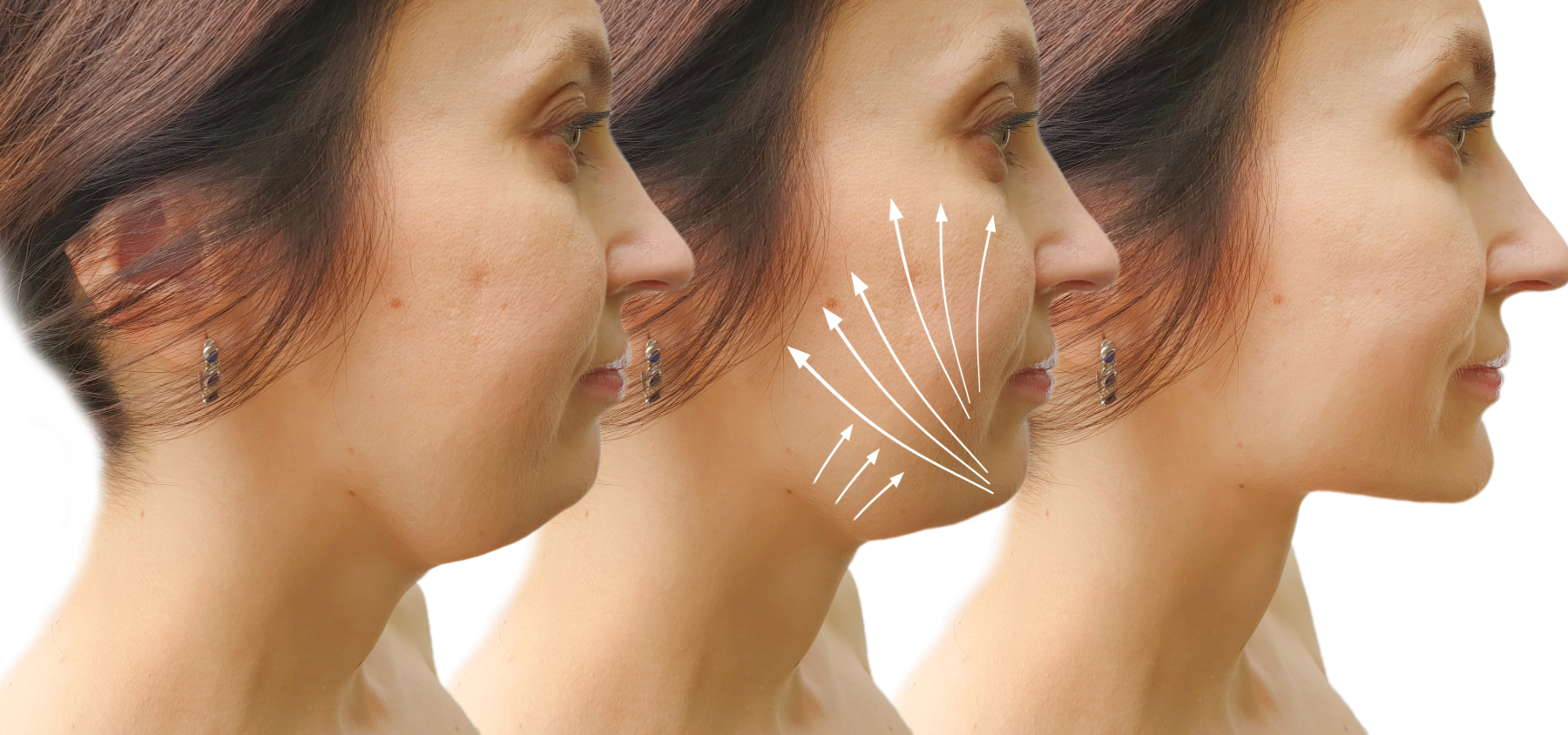 Dental Why’s: Why Your Tongue Is Secretly Ruining Your Airway and Your Smile