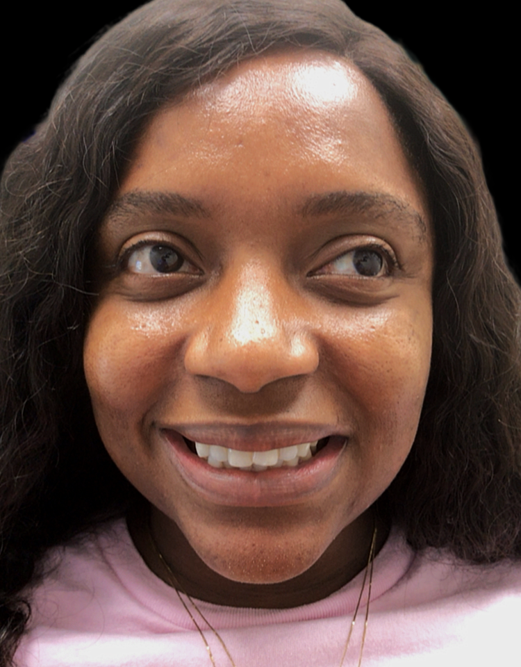 Before Smile
