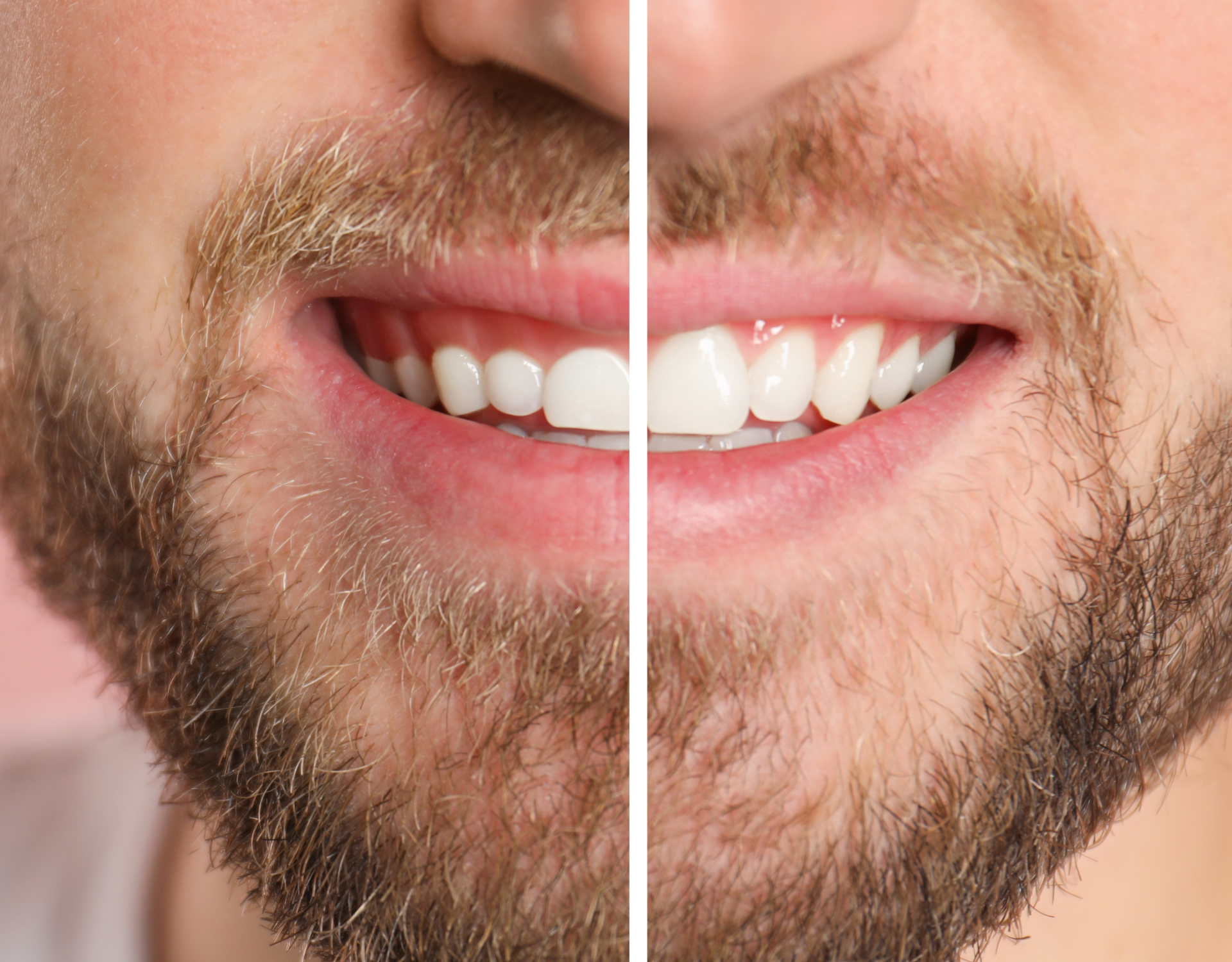 Gum reshaping cosmetic dentistry Richmond TX