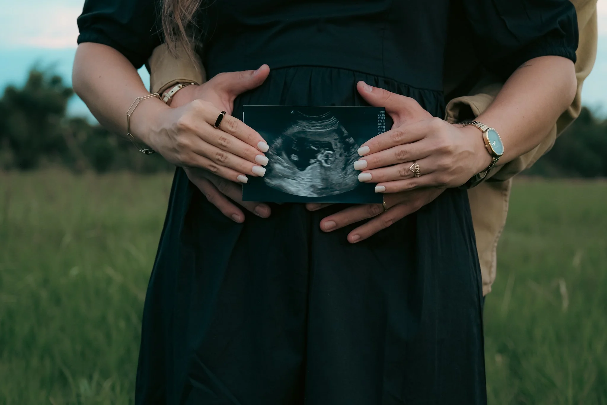 Rudy + Mia - Baby Announcement-58.jpg