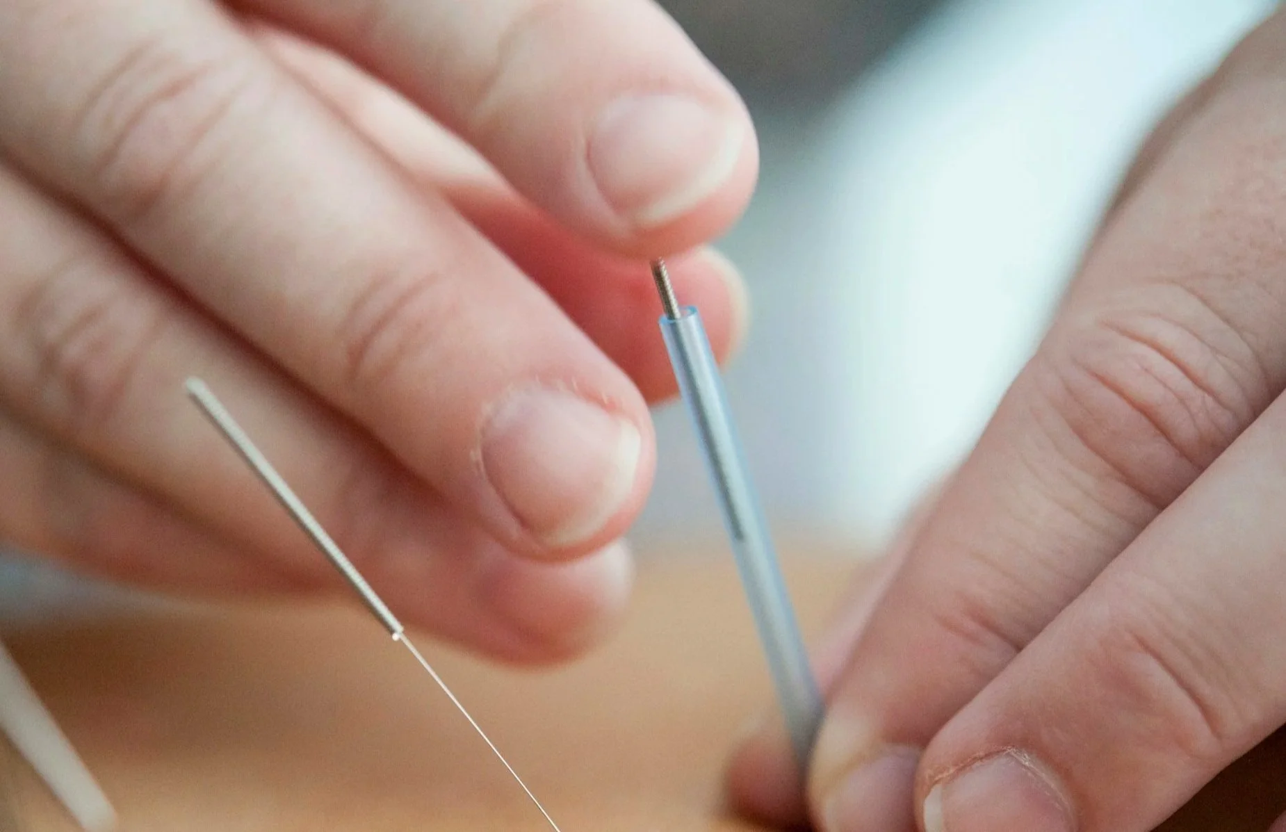 Close-up of a person's hand inserting a needle into acupuncture points.