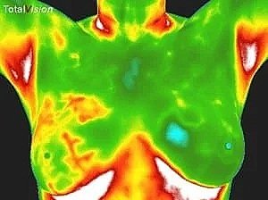 A comfortable bathrobe on a table showing the non-invasive experience of Breast thermography at Wellness Restoration in Jackson, MS, which is used to assess Inflammation and pain, for Circulatory evaluation, and for Preventative health monitoring.