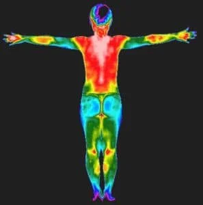 Thermography inflammation scan Jackson, MS