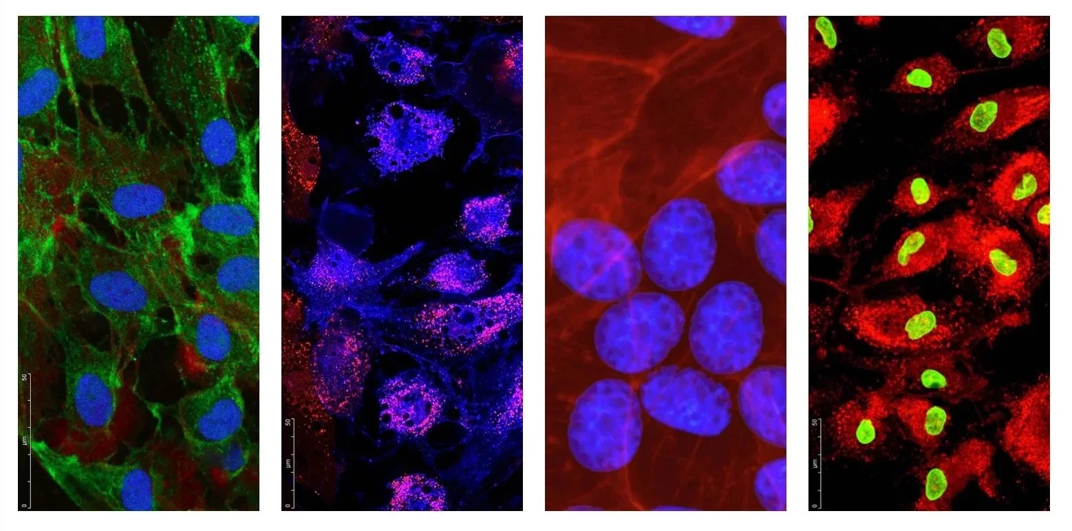 Mesenchymal Stem Cell Sources: Why Umbilical Cord–Derived MSCs Are Setting the New Standard