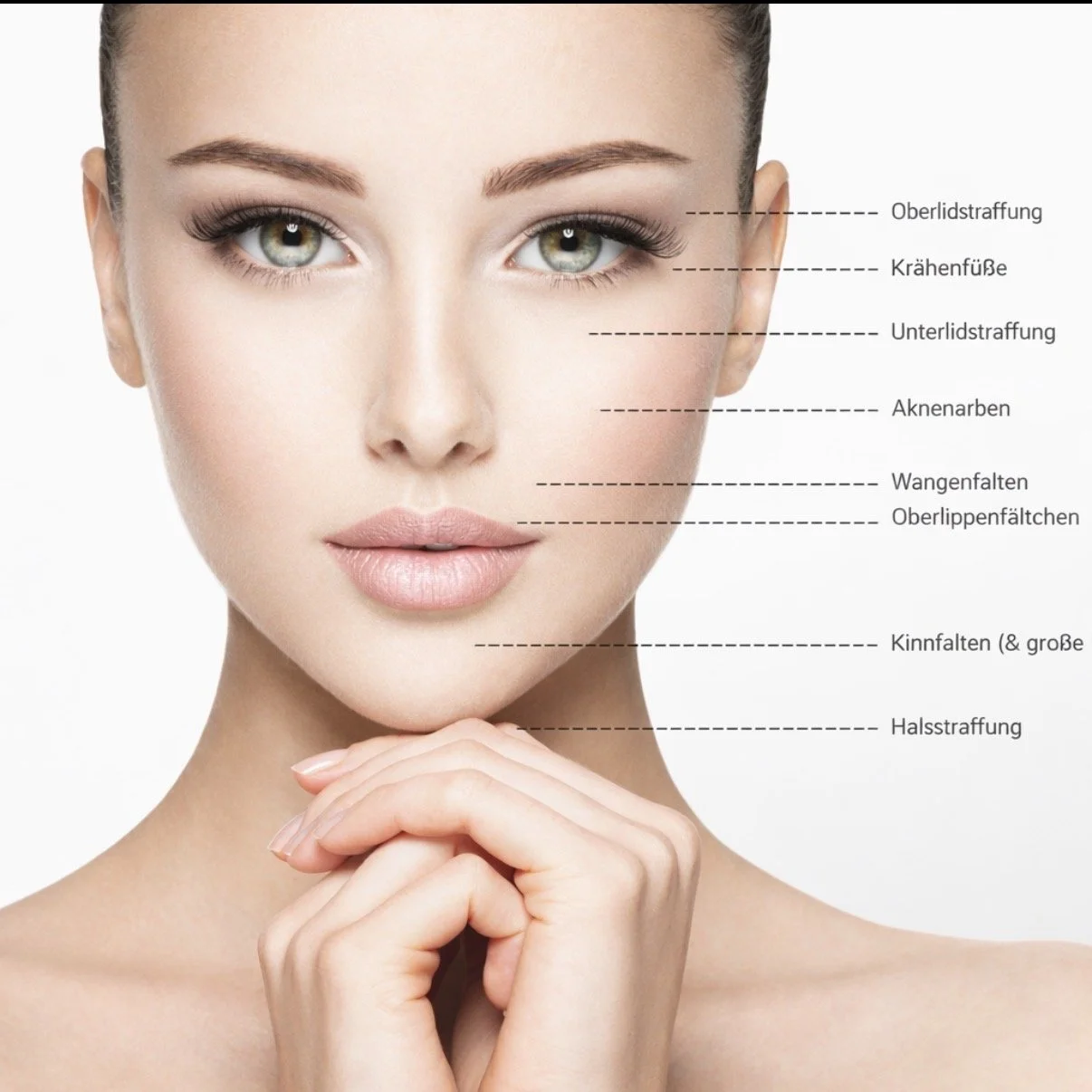 PLANOPLAS PLASMA  BEHANDLUNG