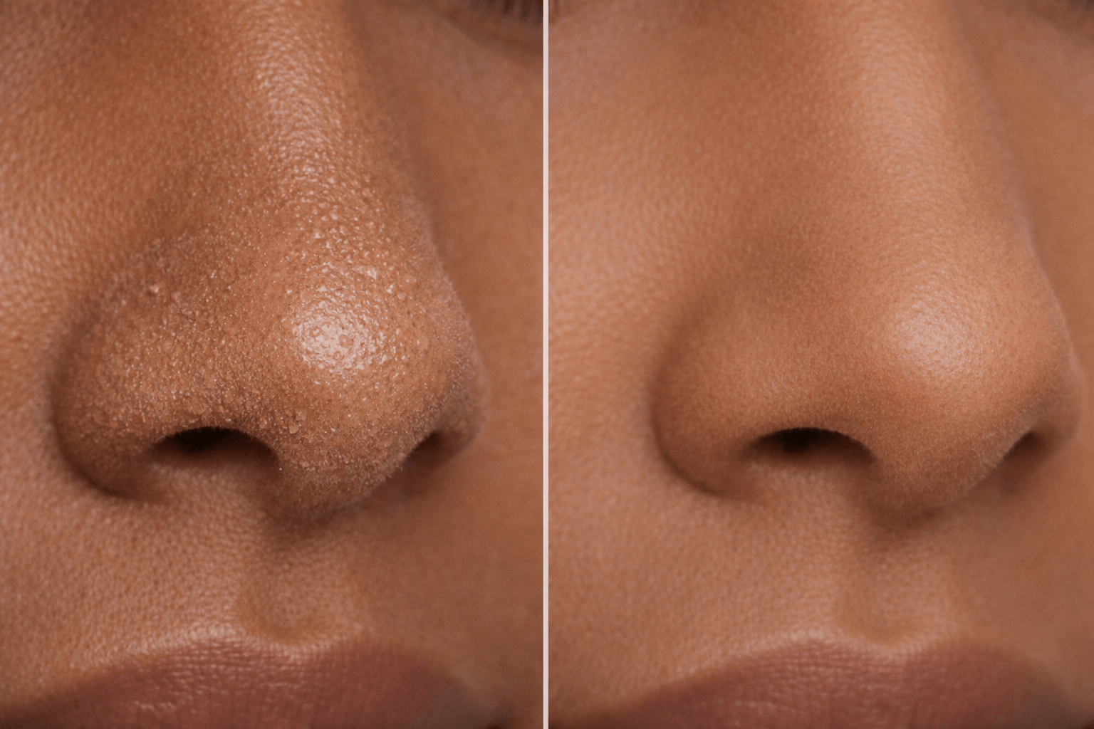 Foundation separating on nose compared to smooth makeup application showing texture and patchiness vs even skin