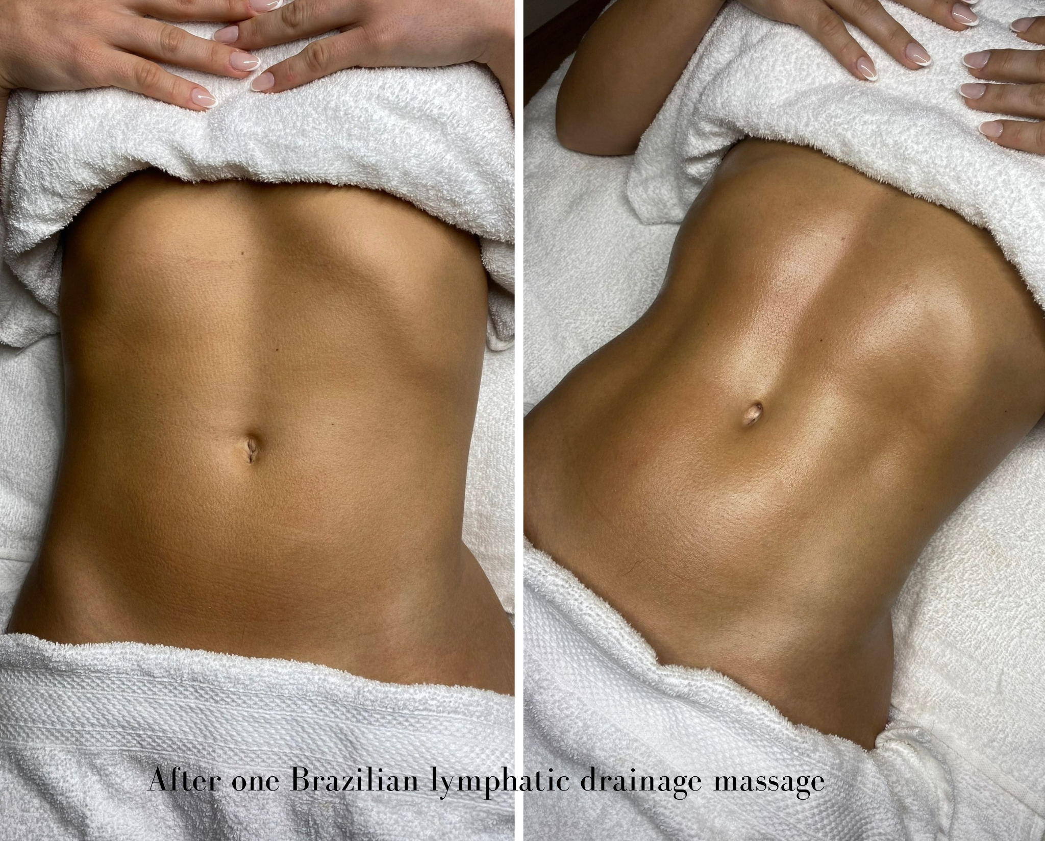 Side-by-side images of a person's bare torso after a Brazilian lymphatic drainage massage, showing smooth, toned skin with slight differences in texture and hue, under a white towel.