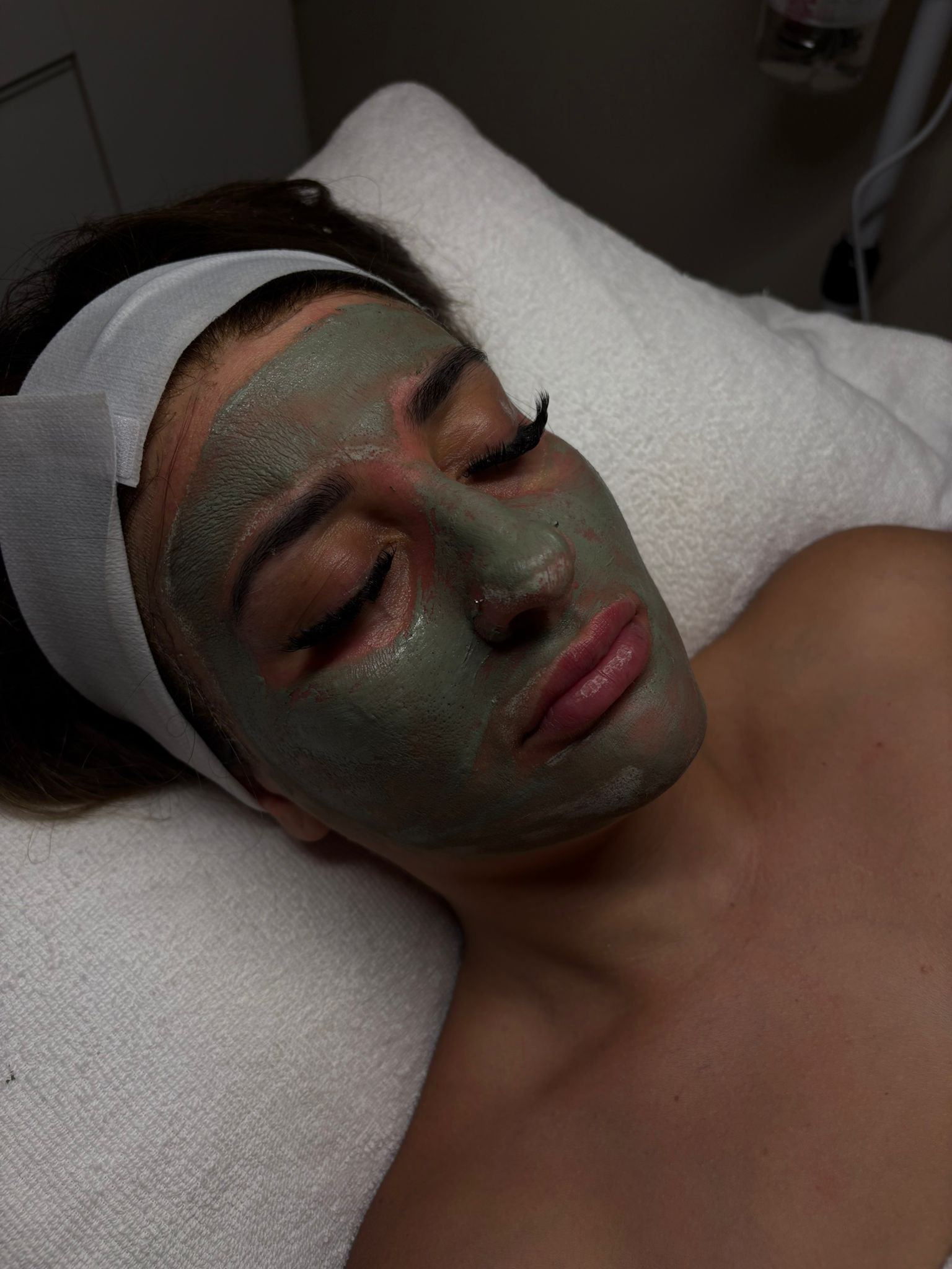 Deep Sea Spicule Peel