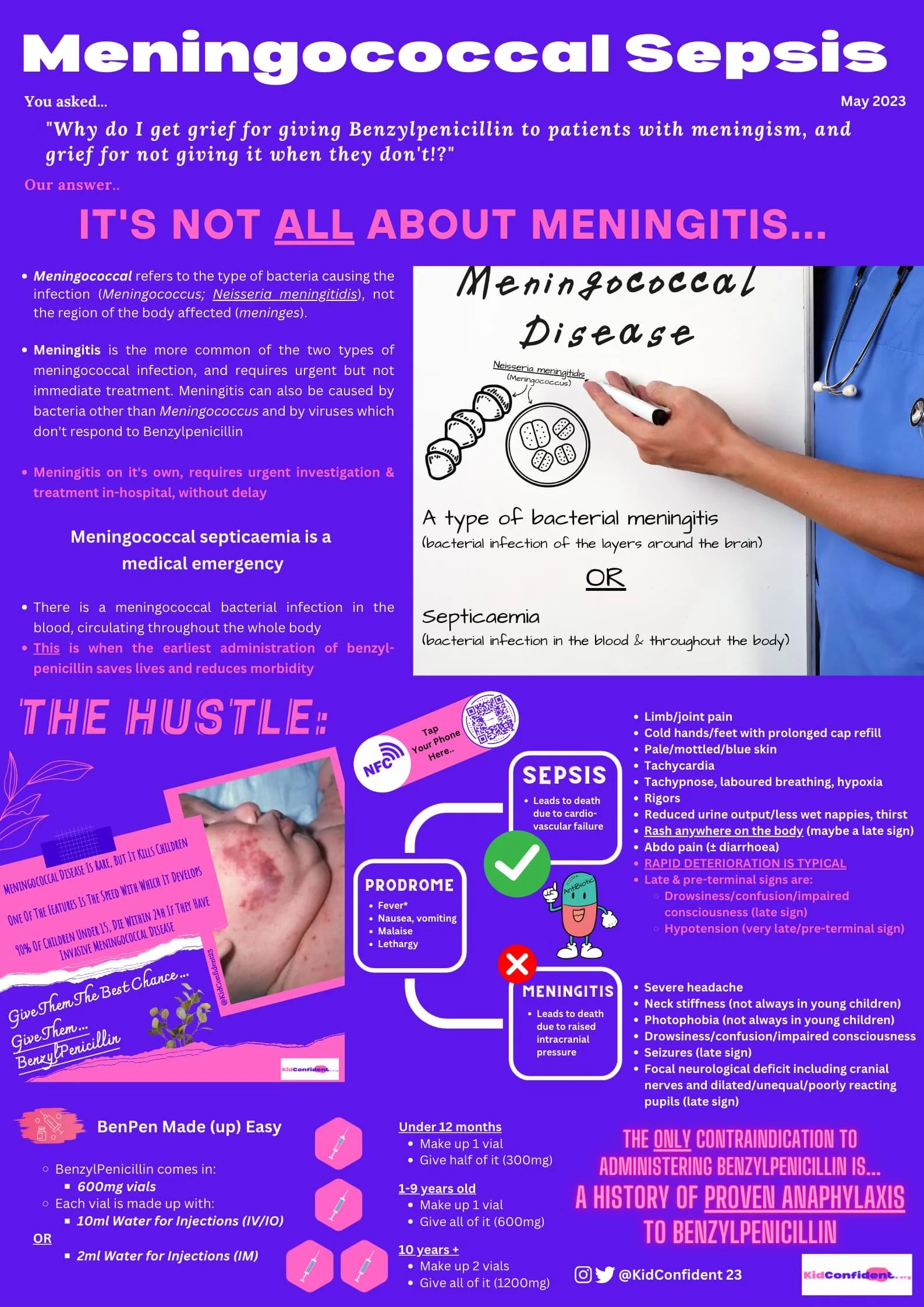 Meningococcal sepsis, meningism, meningitis, meningococcal disease, benzylpenicillin
