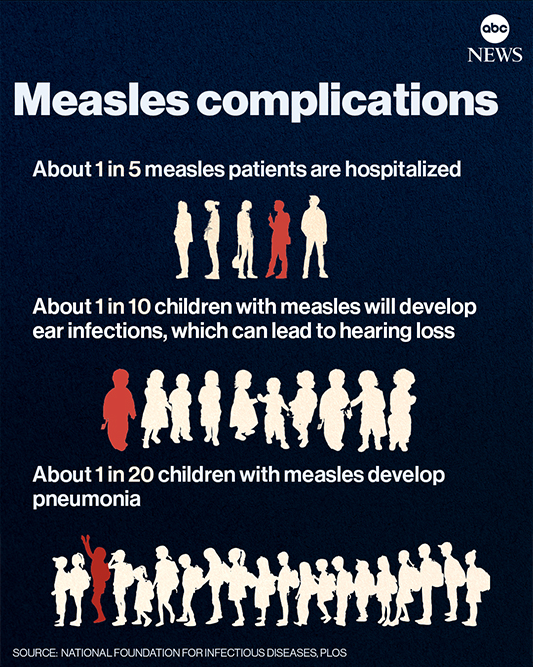 Infographic about measles complications showing that 1 in 5 measles patients are hospitalized, 1 in 10 children develop ear infections that can cause hearing loss, and 1 in 20 children develop pneumonia, with illustrated silhouettes of children and adults.