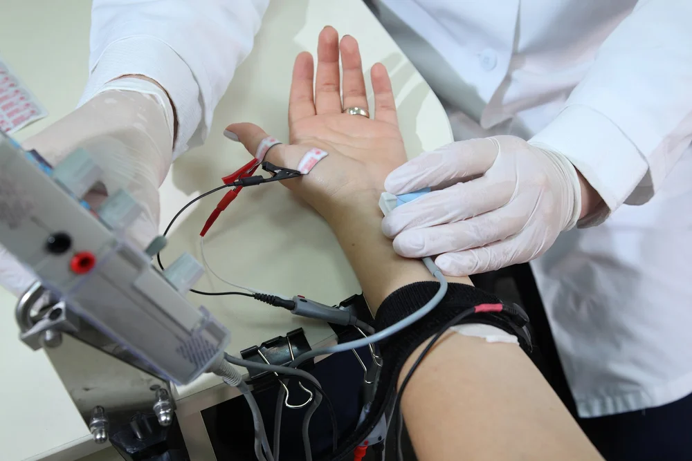 Clinician performing a nerve conduction study, with small electrodes on the patient&rsquo;s fingers and a stimulator at the wrist