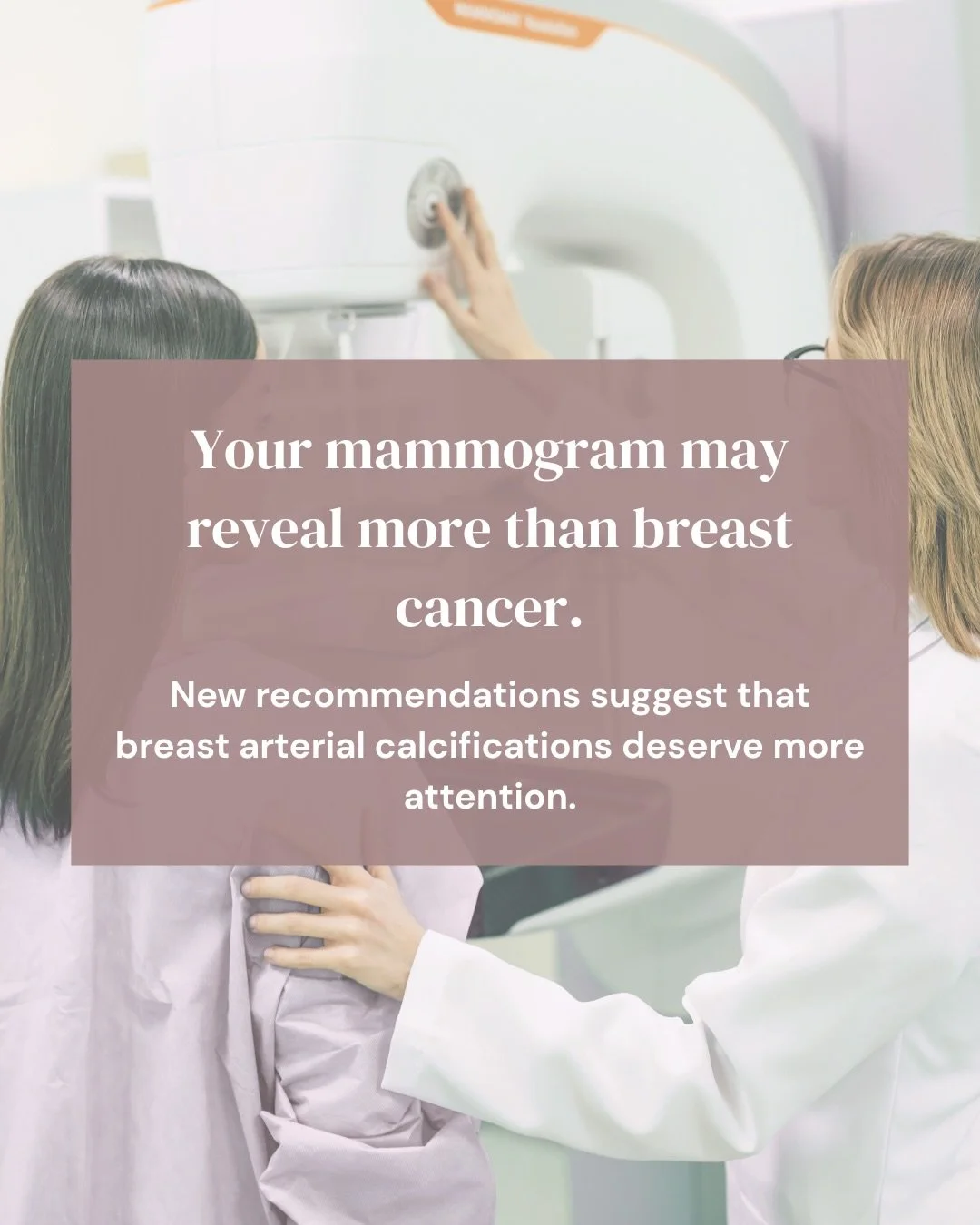 For years, breast arterial calcifications seen on mammograms were often considered an incidental finding.
Now, that thinking is changing.
New research and expert recommendations suggest these calcifications may provide important insight into a woman&
