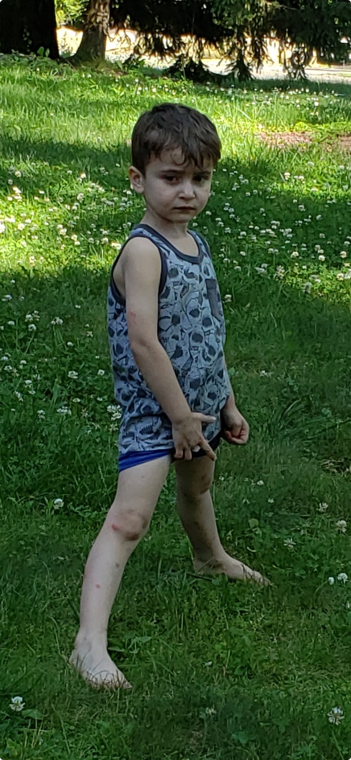 The Day We Discovered the Scales