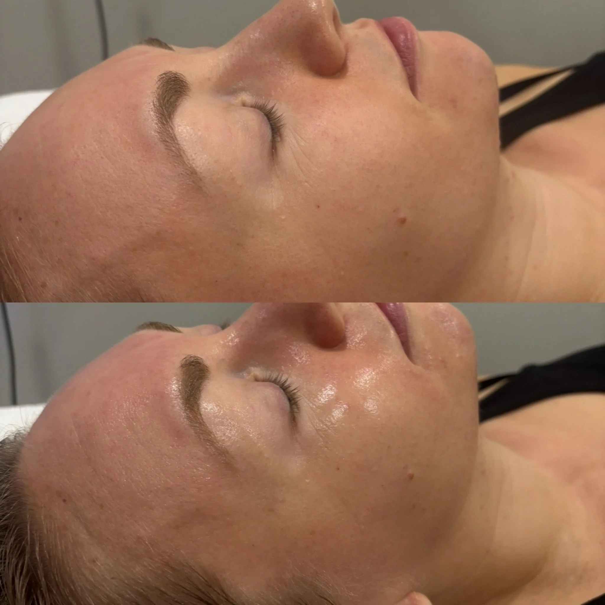Before and after images of a woman receiving a skincare treatment, showing improved skin glow and texture.