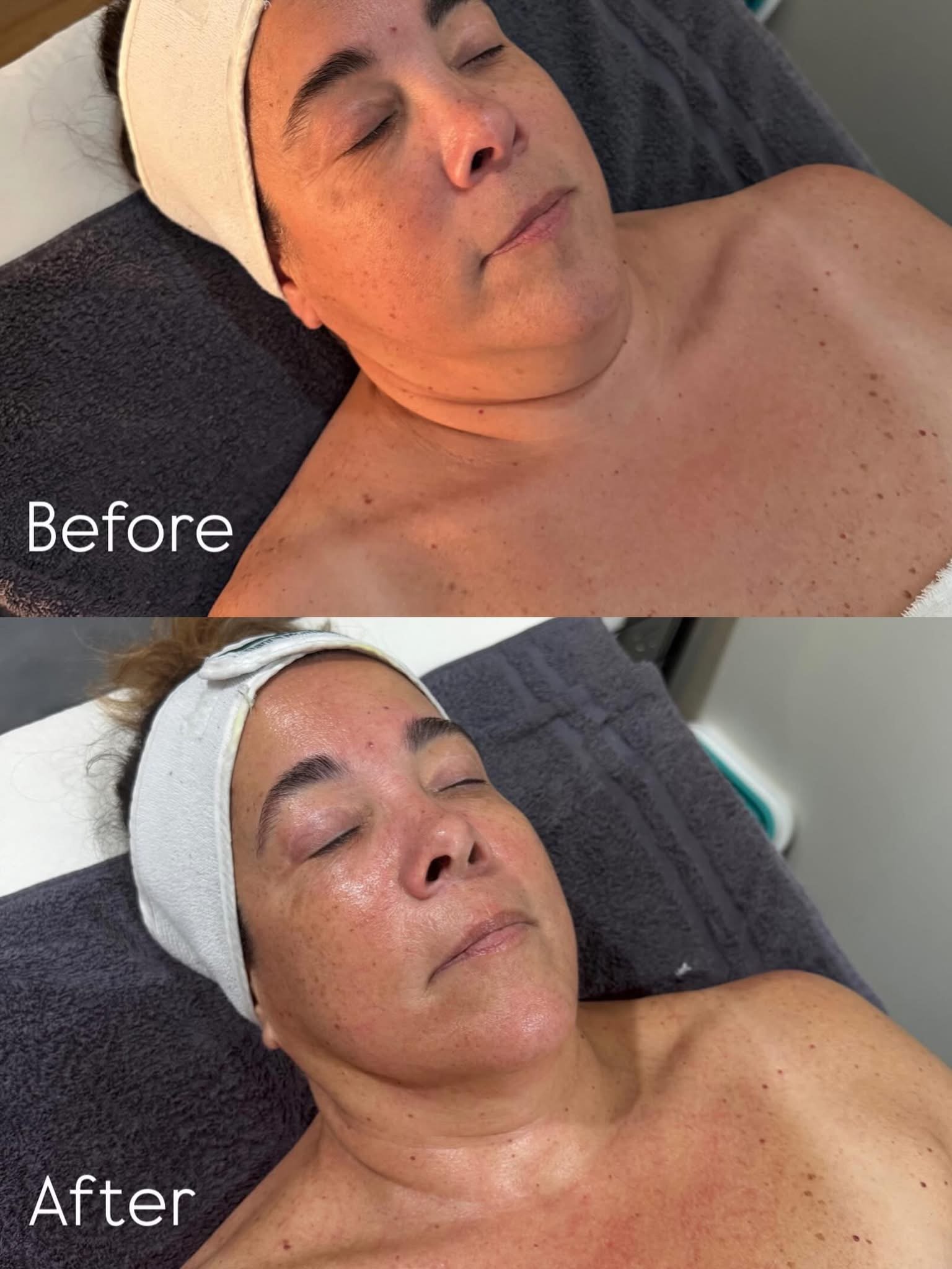DMK Enzyme Therapy by Grace