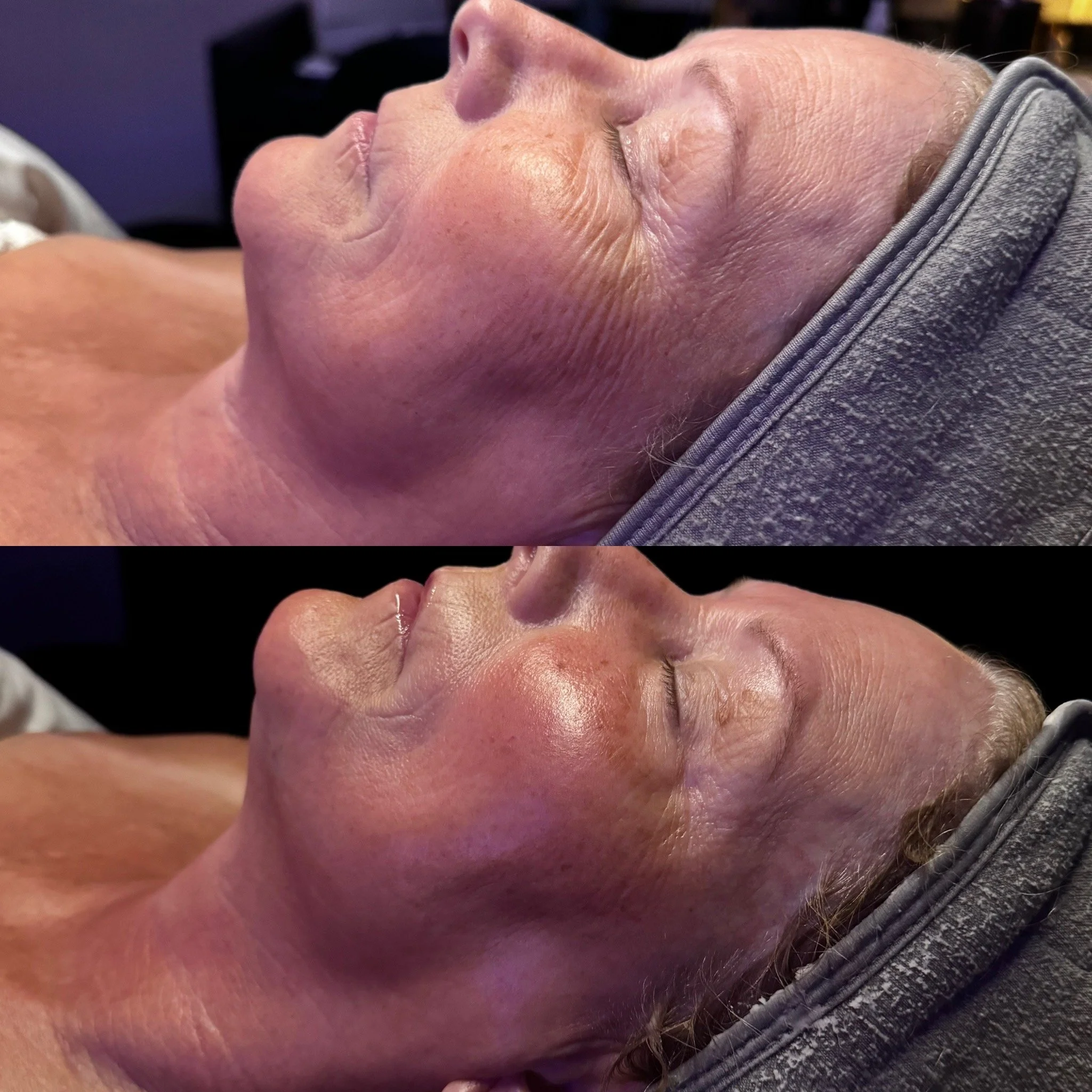 DMK Enzyme Treatment by Karissa