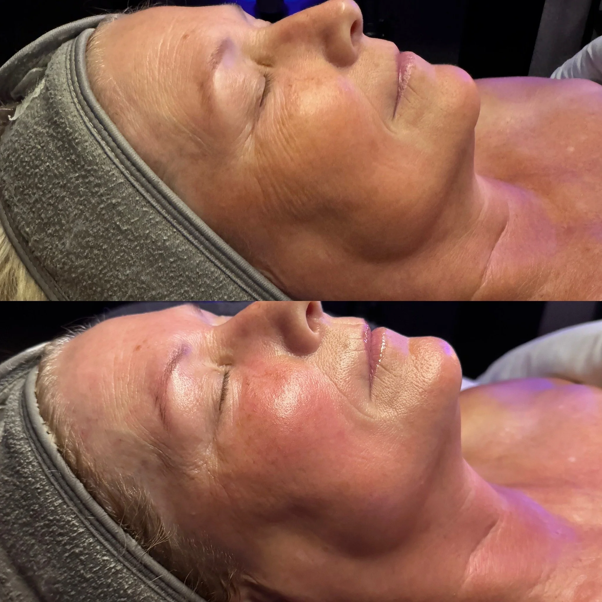 DMK Enzyme Treatment by Karissa