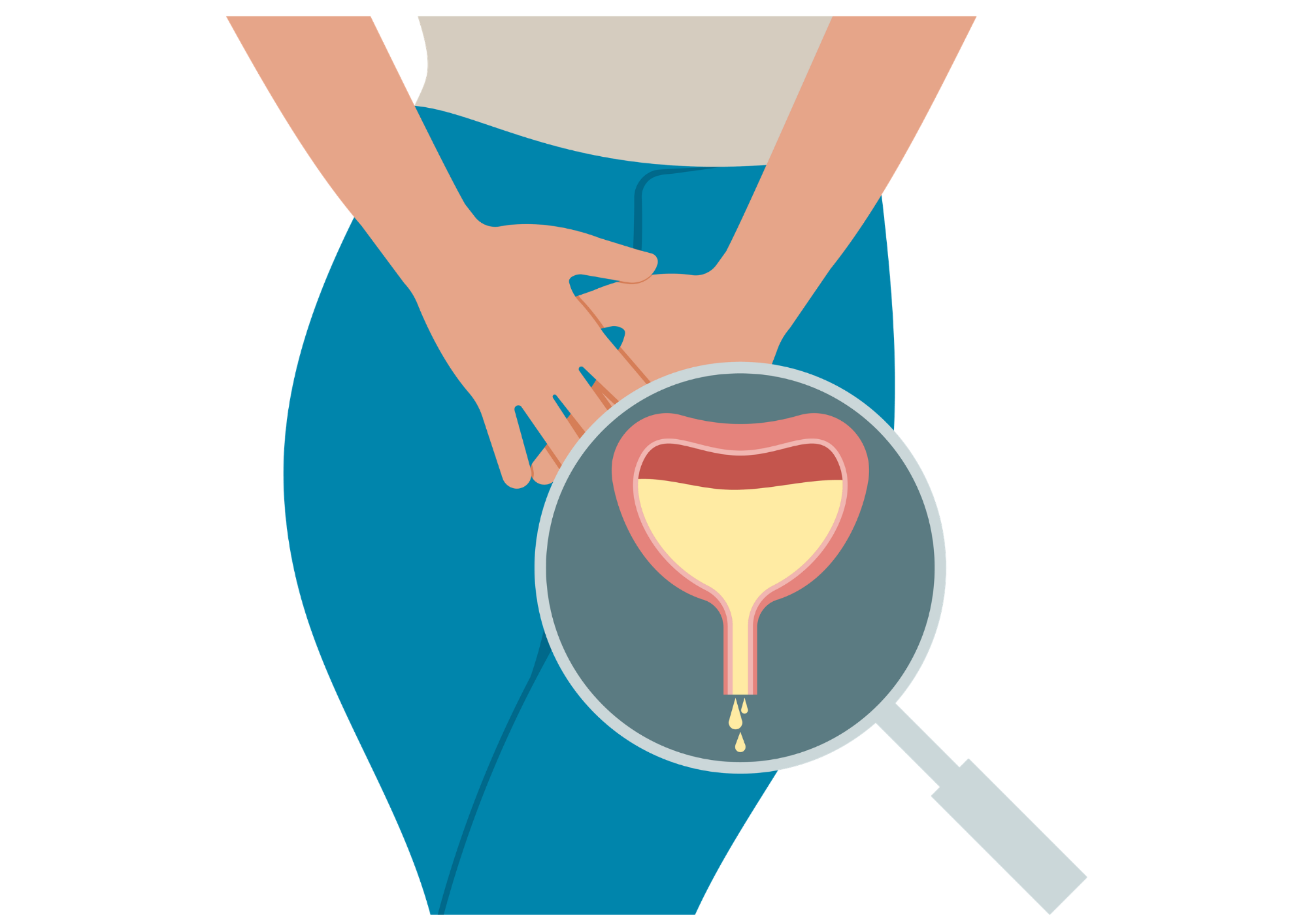 To Kegel or Not to Kegel?