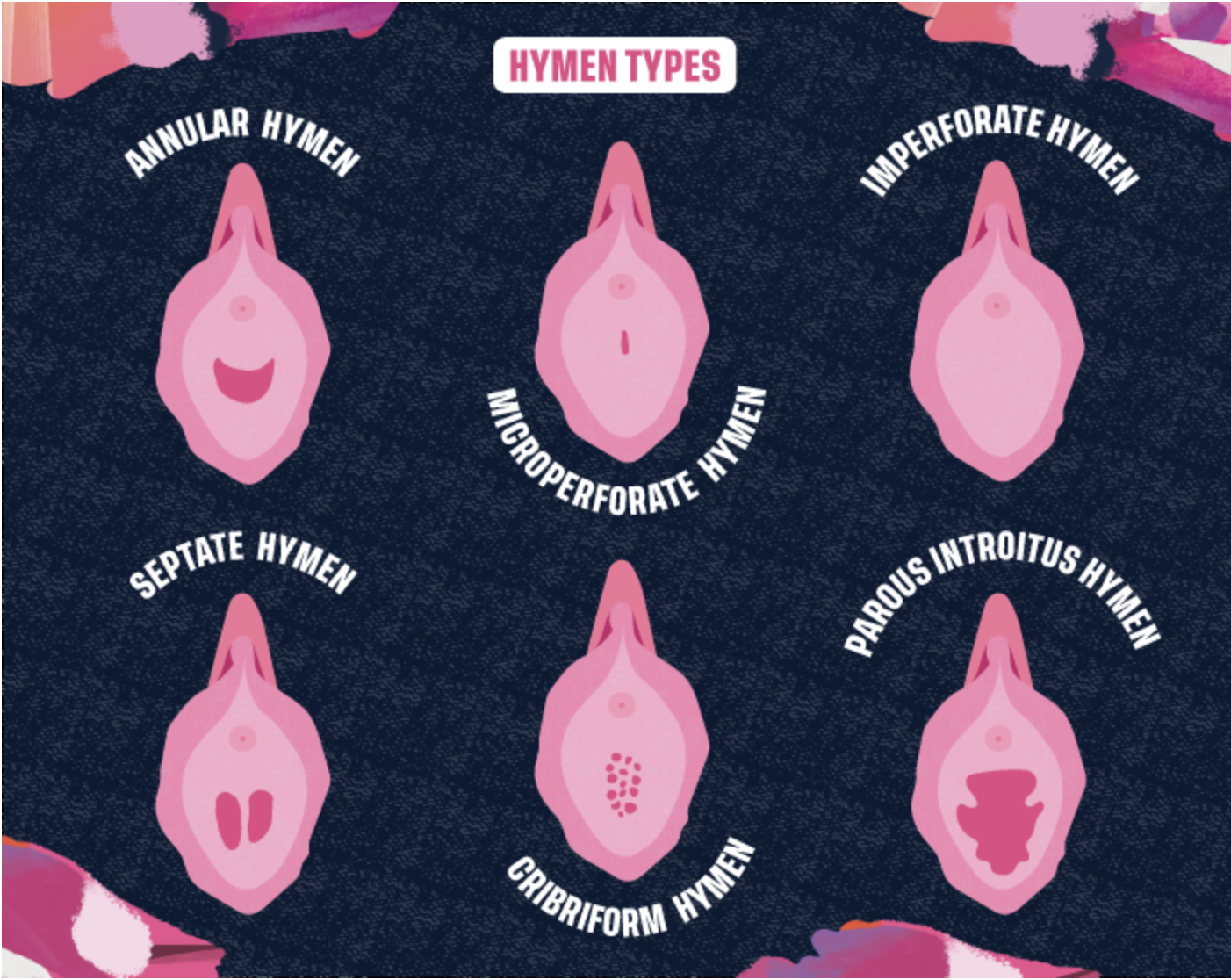 From the website, lovelibra.com, is featured drawings of 6 different types of hymens including: annular, microperforate, imperforate, septate, cribriform, and parous introitus. The images are pink set to a black/dark blue background.