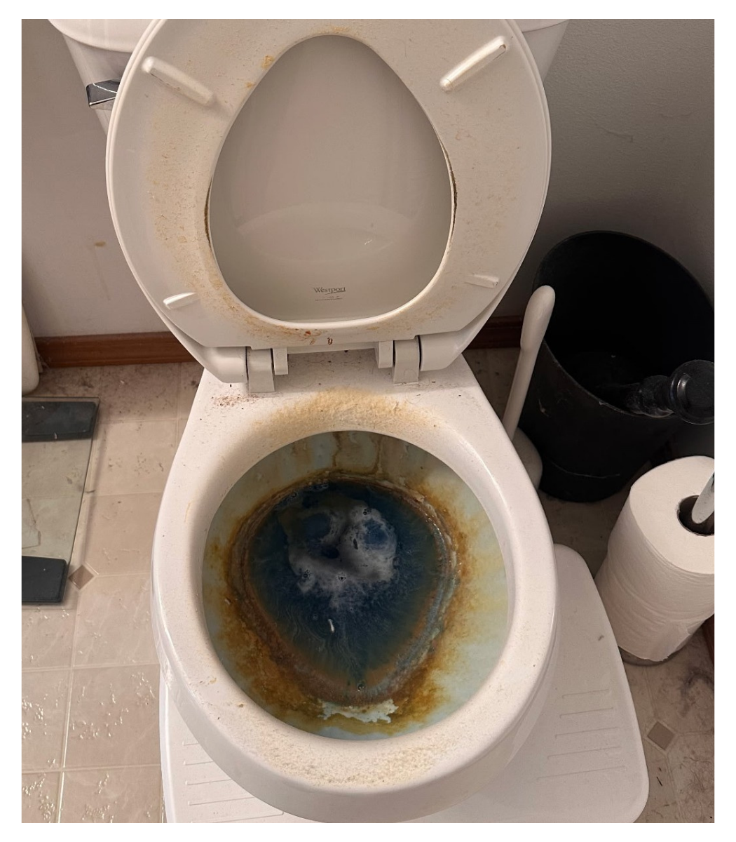 Before a very gross and dirty toilet