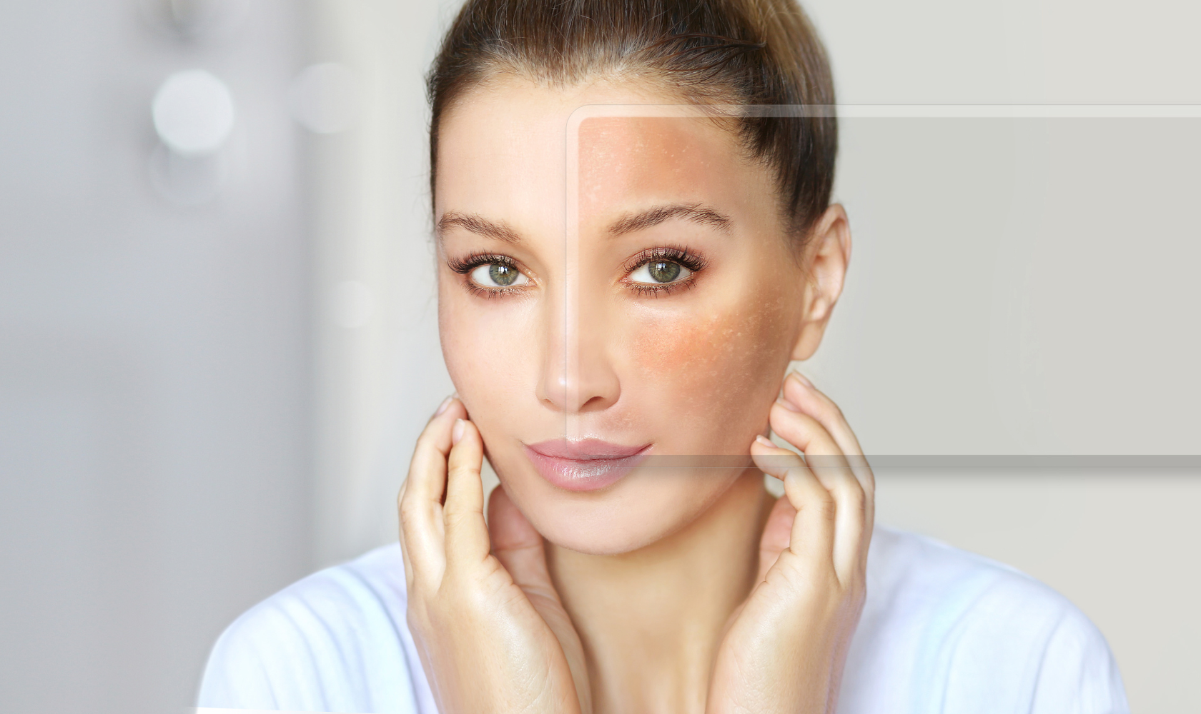 Medspa in Angola, IN, 46703 | Melasma Near Me