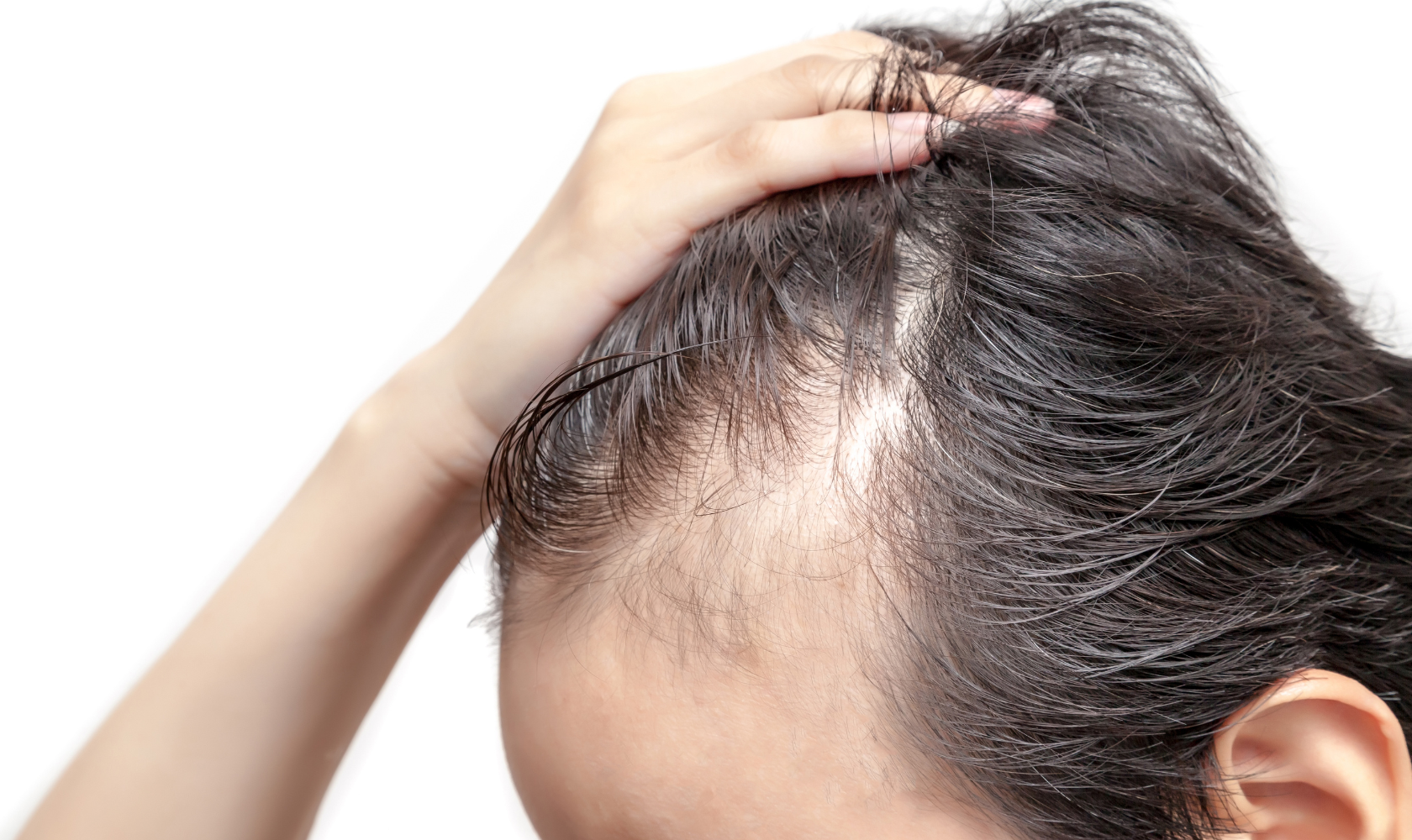 Medspa in Angola, IN, 46703 | Alopecia Near Me
