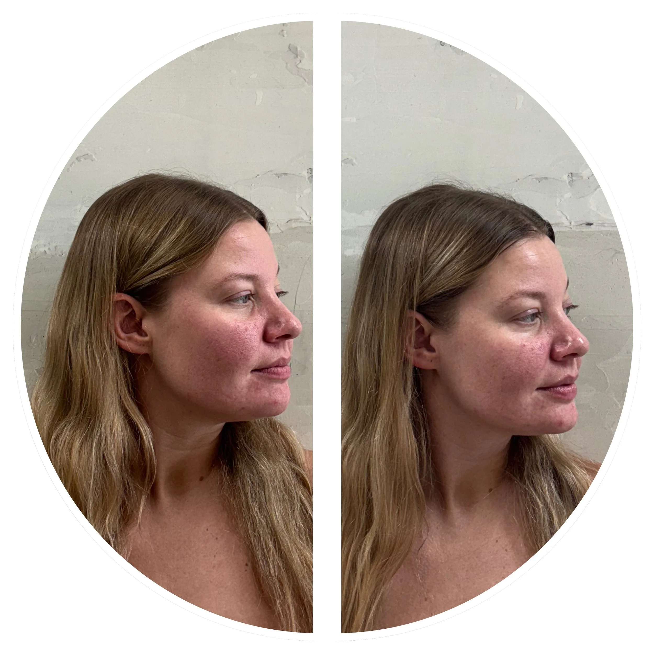 The Sculptural Facial