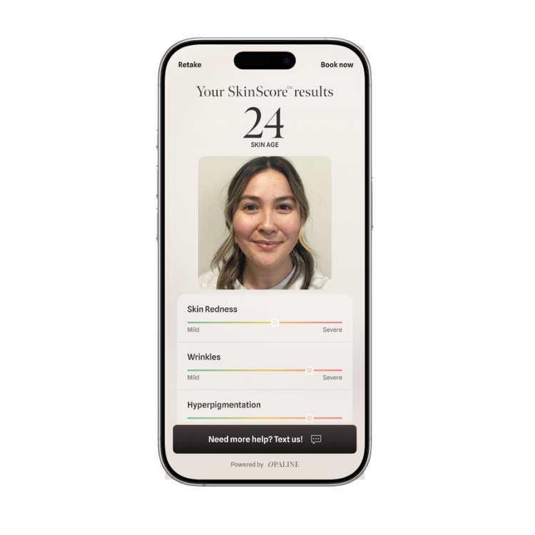Smartphone displaying a skin analysis app with a woman's face, showing skin age of 24 and sliders for skin redness, wrinkles, and hyperpigmentation.